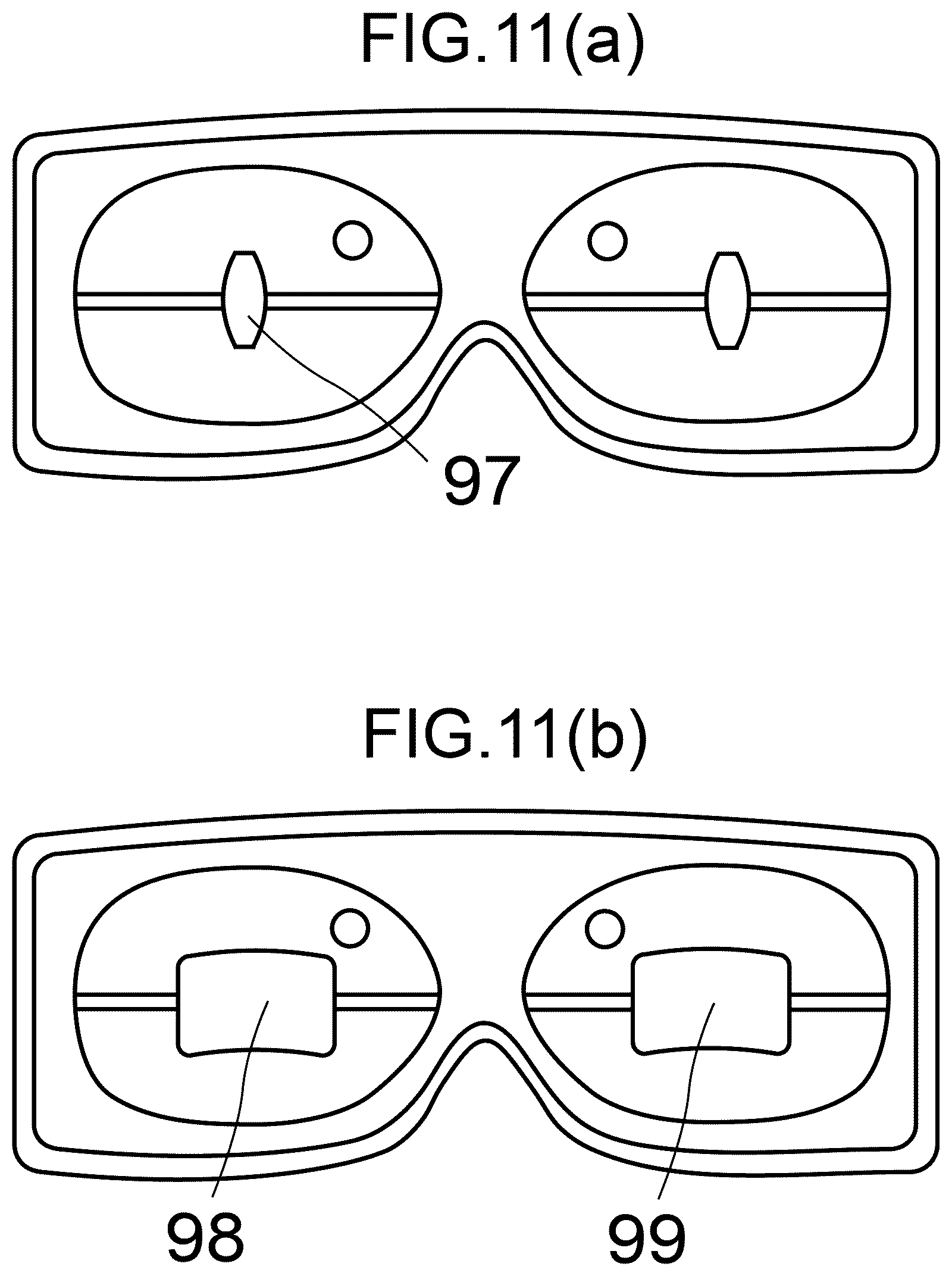 Patent US12508192 Figure 11 – Device and method for dry eye treatment