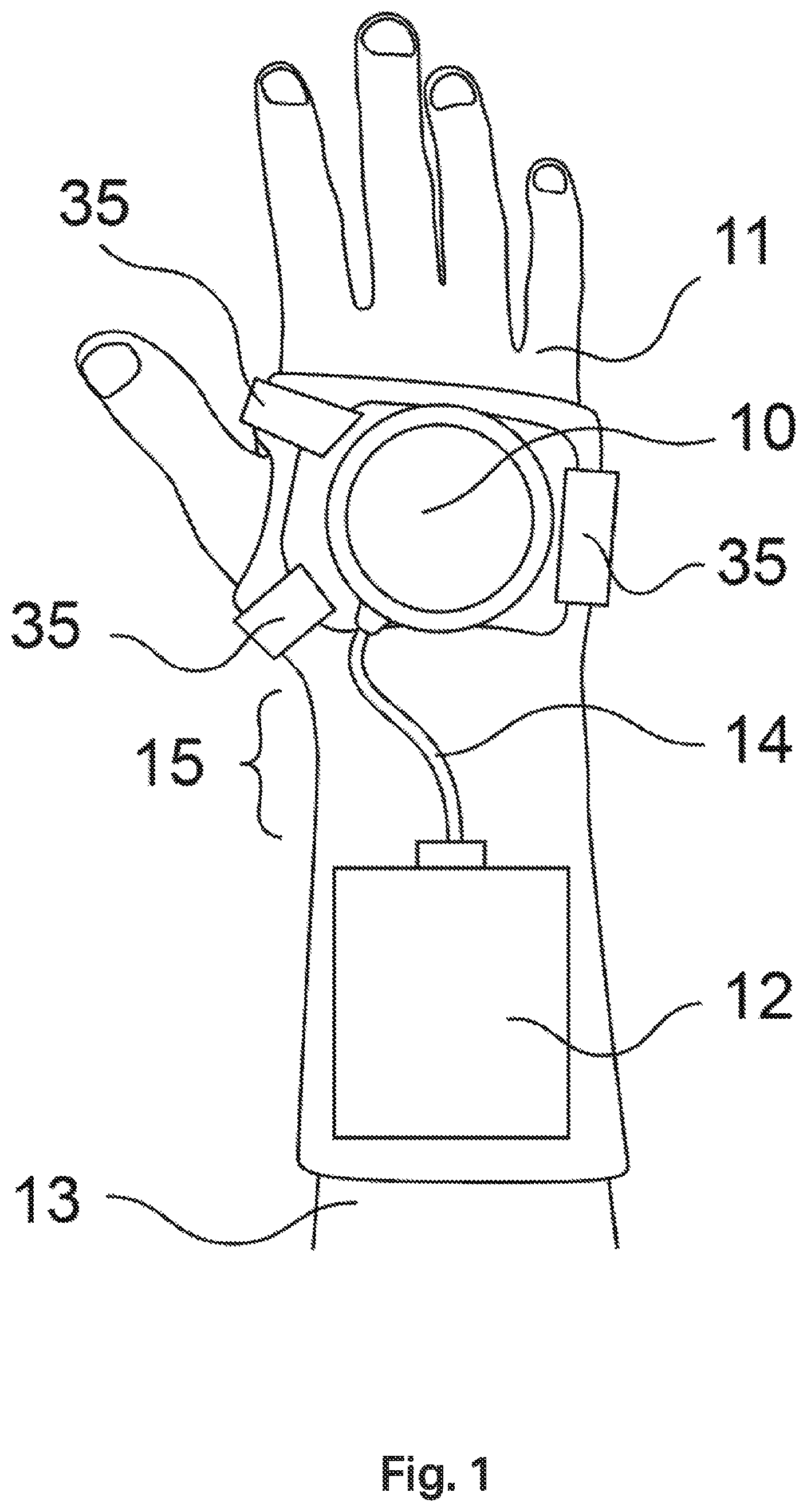 Patent US12508199 Figure 1 – Tremor stabilisation apparatus