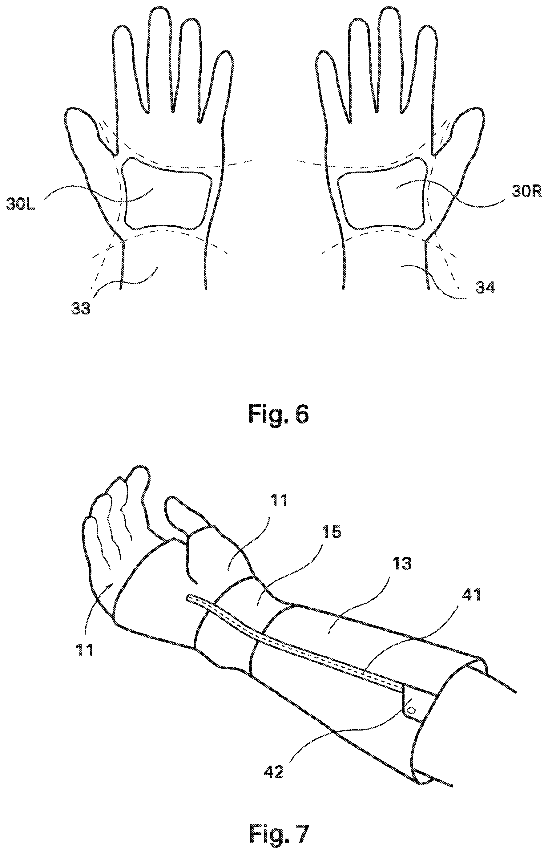 Patent US12508199 Figure 4 – Tremor stabilisation apparatus