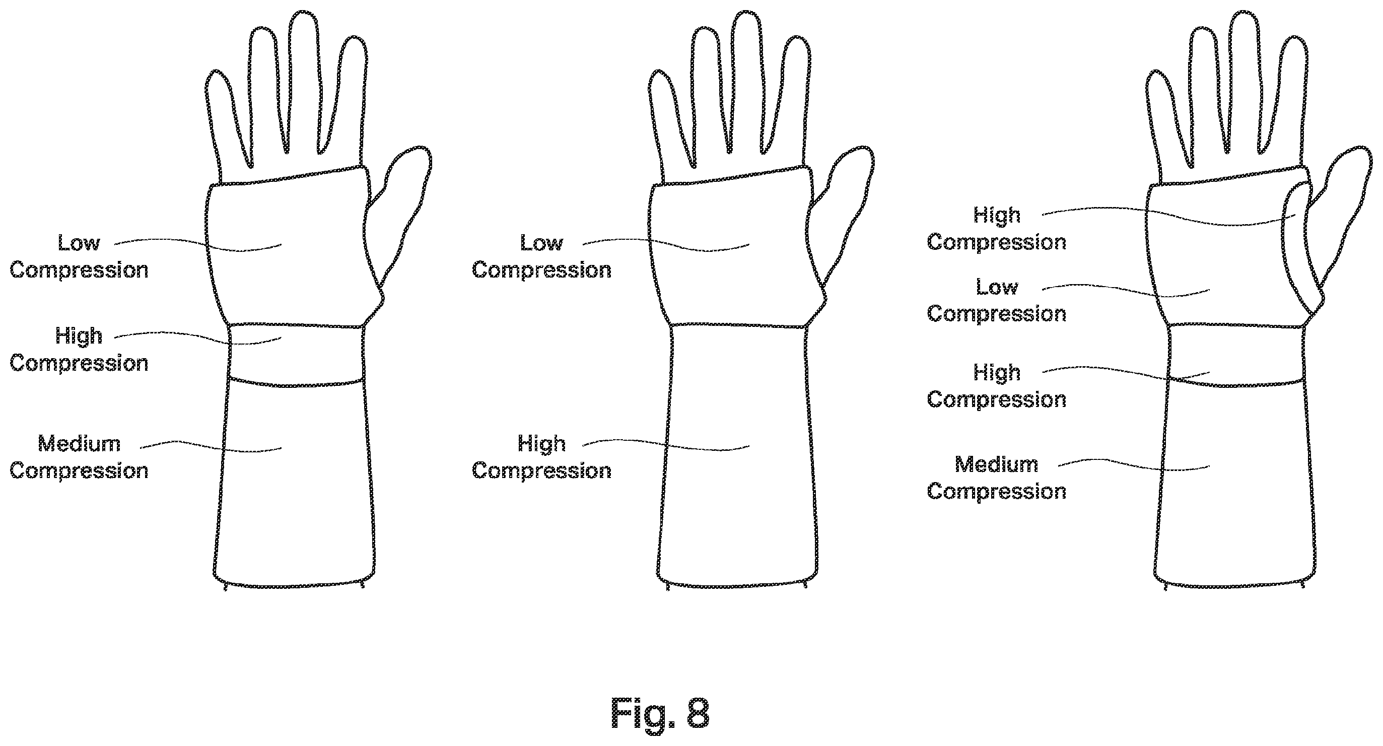 Patent US12508199 Figure 5 – Tremor stabilisation apparatus