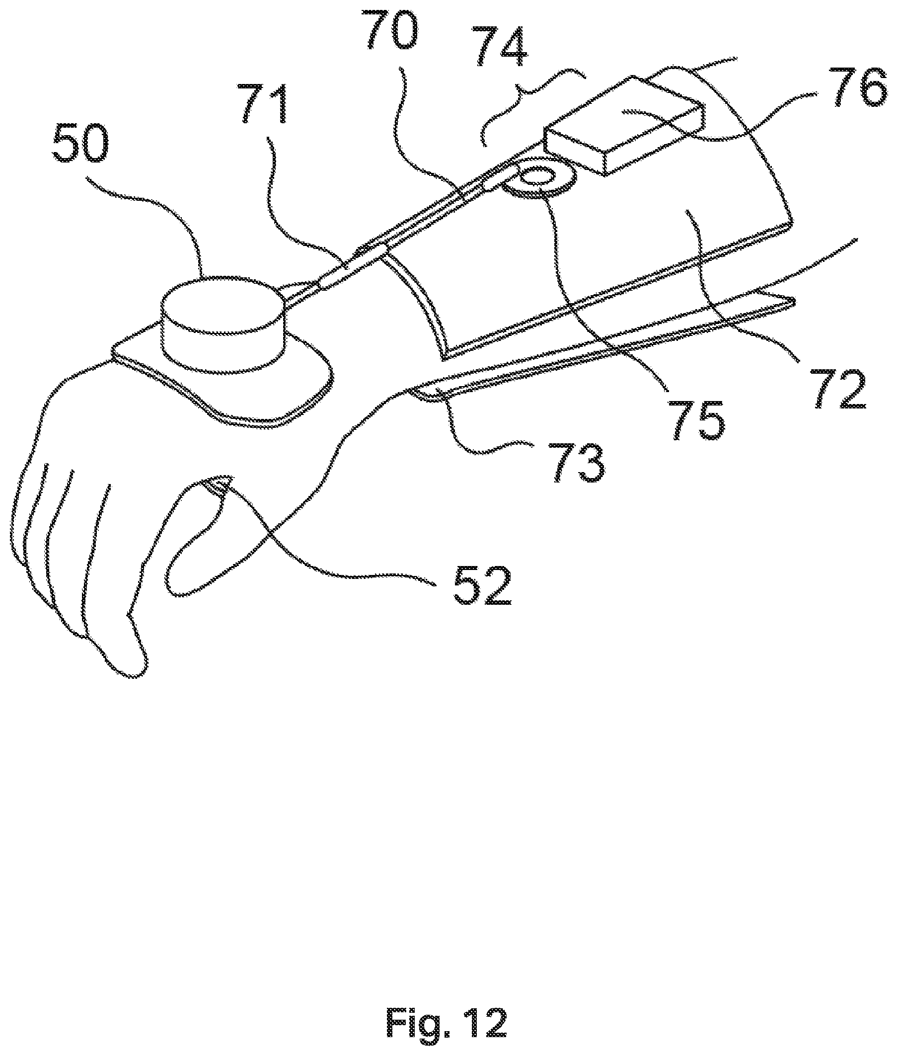 Patent US12508199 Figure 11 – Tremor stabilisation apparatus