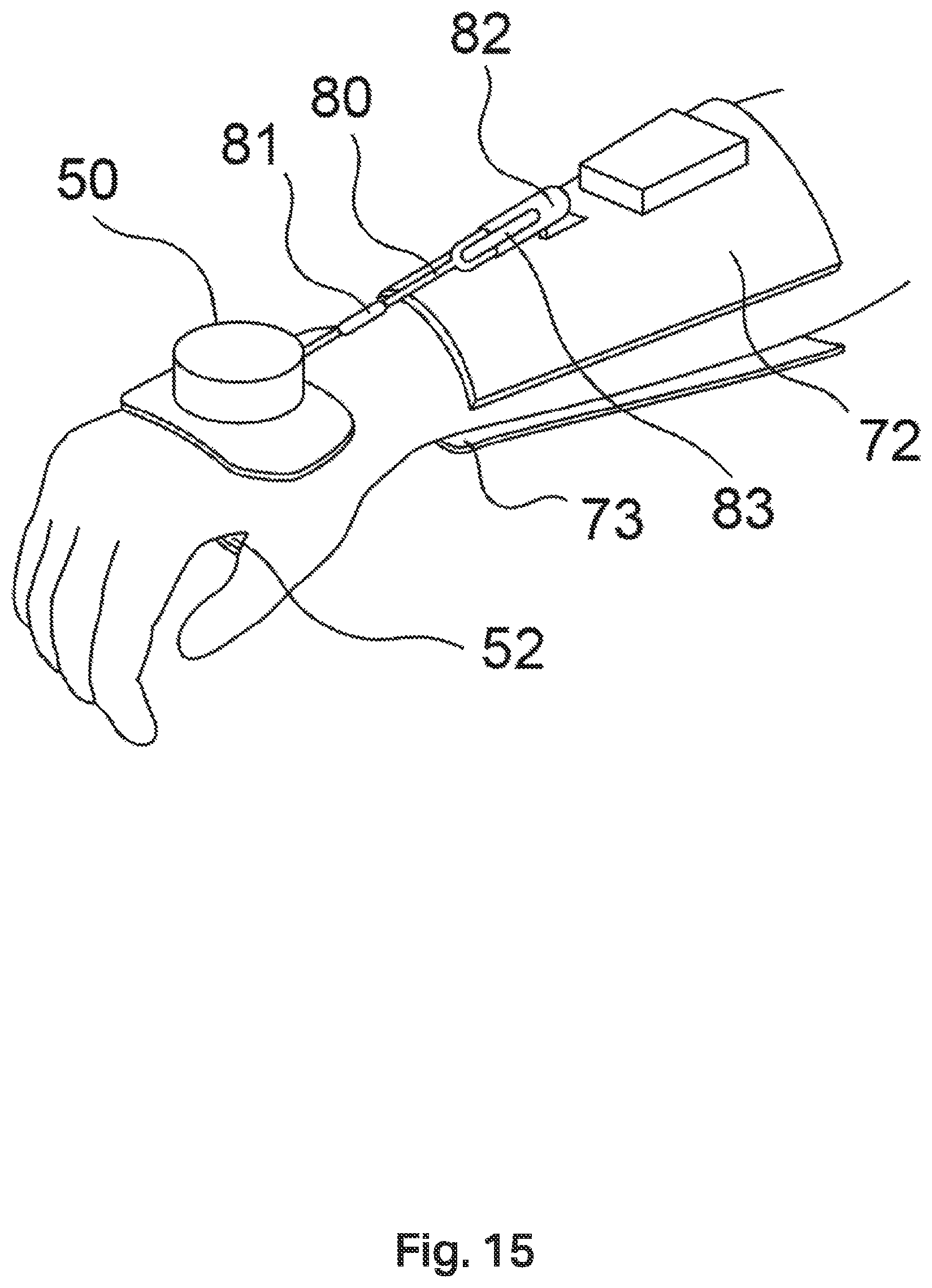 Patent US12508199 Figure 14 – Tremor stabilisation apparatus
