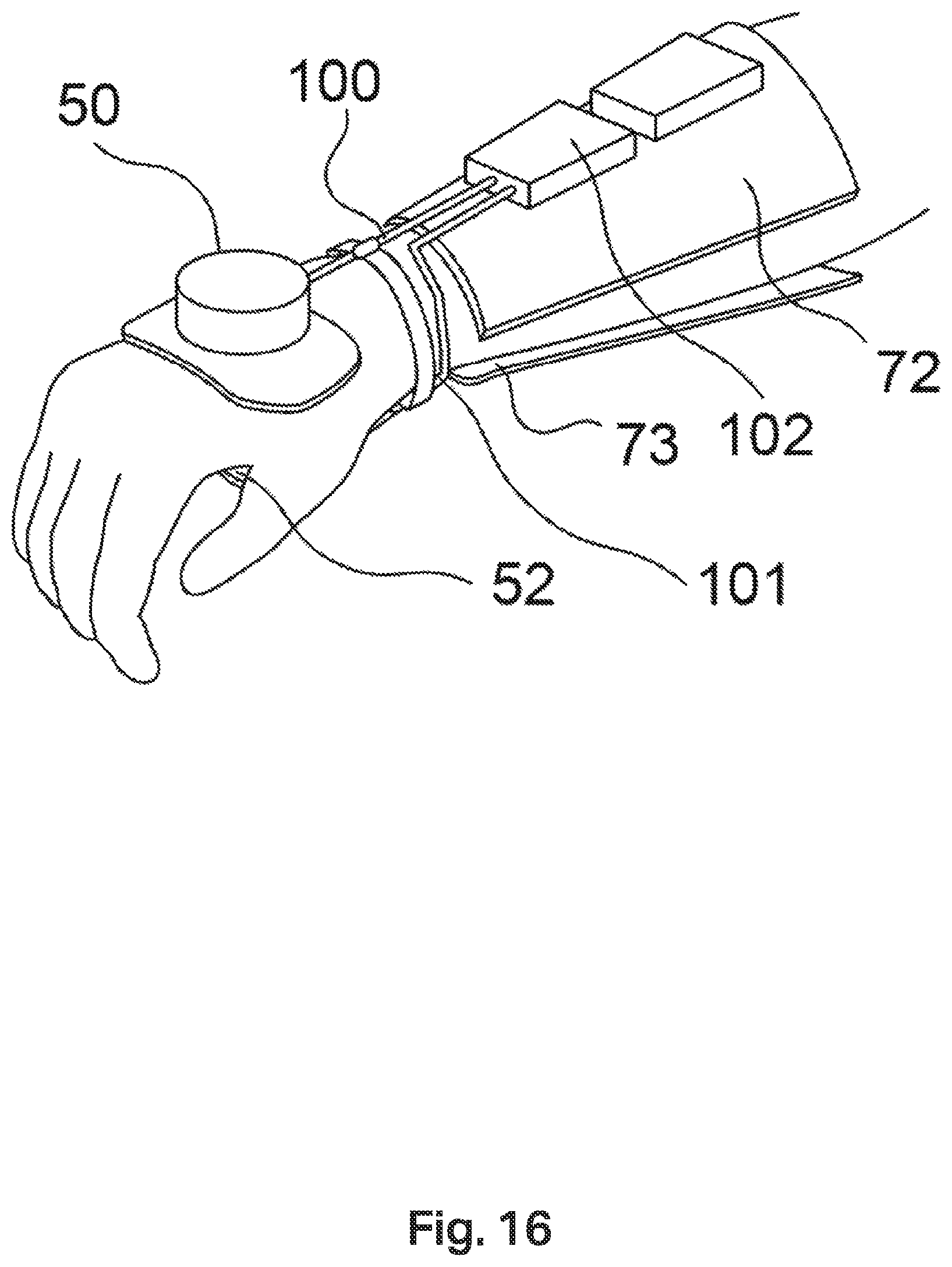 Patent US12508199 Figure 15 – Tremor stabilisation apparatus