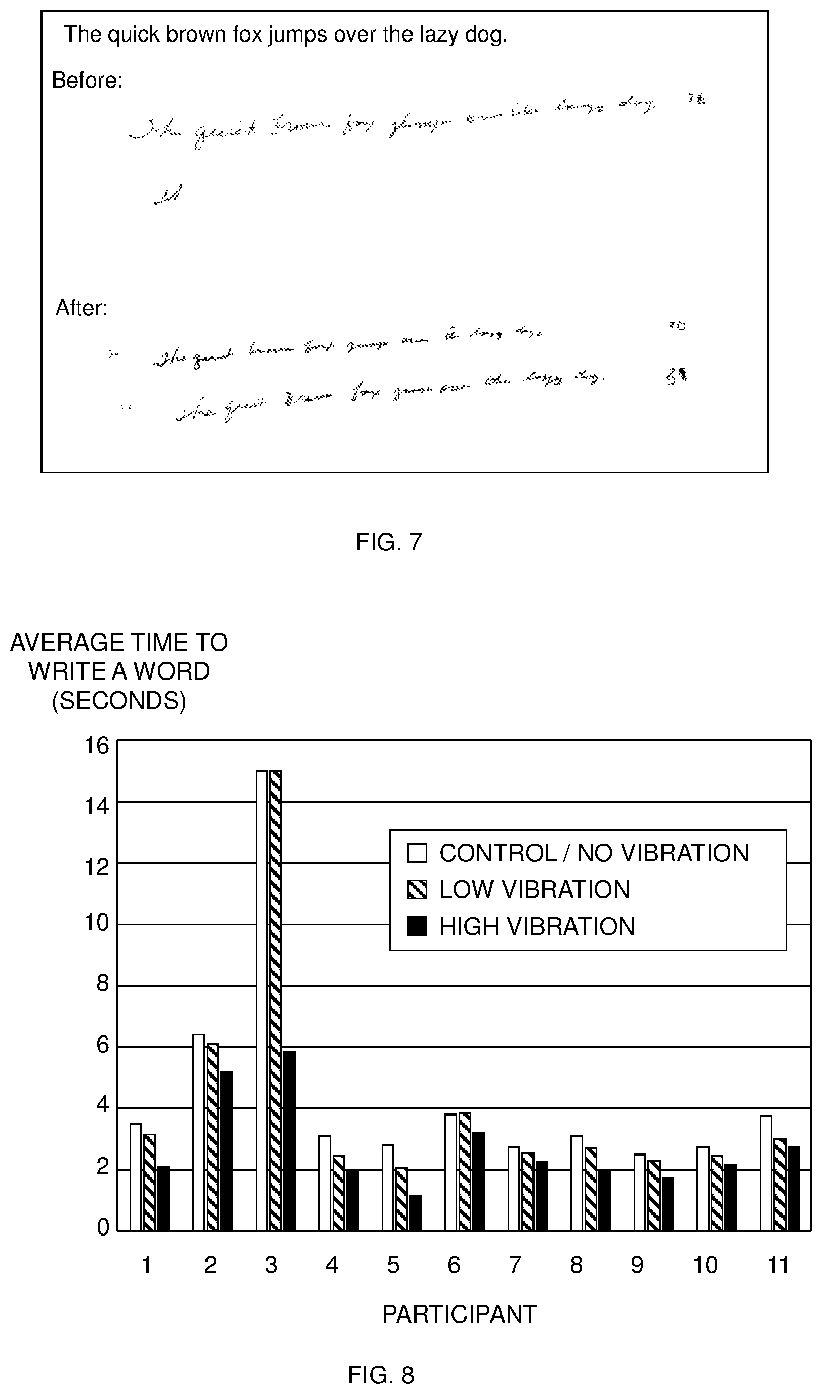 Patent US12508202 Figure 6 – Vibration-induced tremor relief apparatus