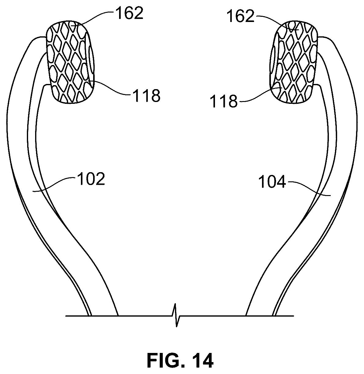 Patent US12508205 Figure 8 – Acupressure device