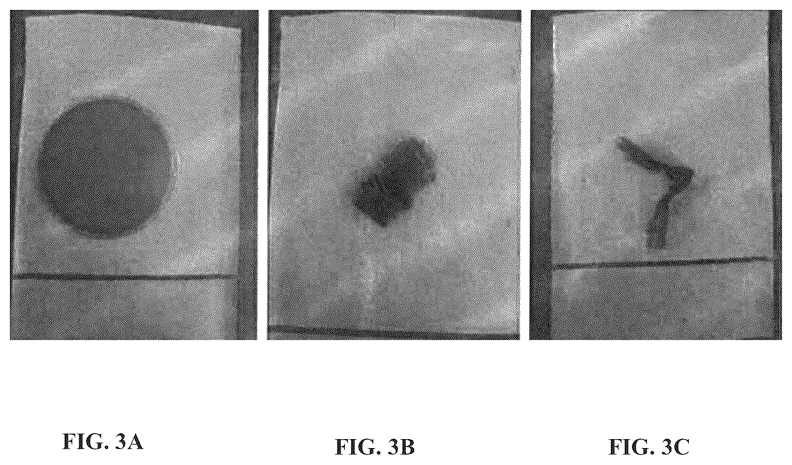 Patent US12508222 Figure 3 – Implantable and biodegradable drug delivery devices and methods of use thereof