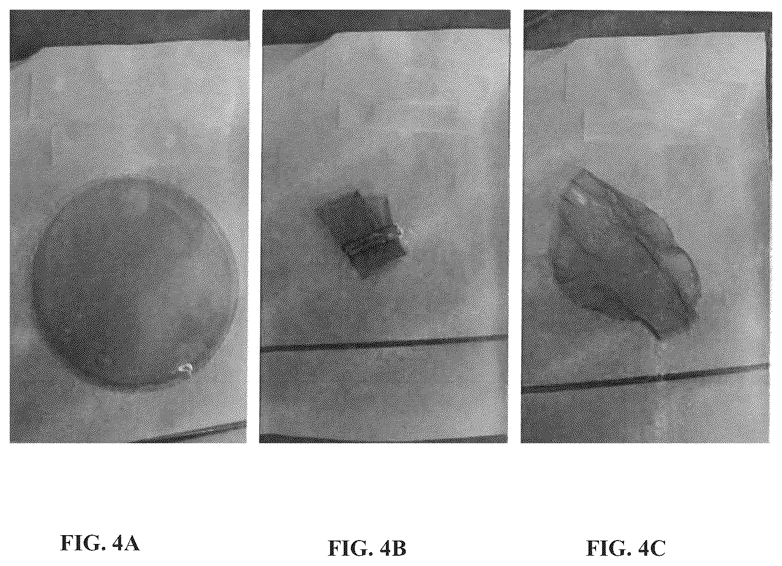 Patent US12508222 Figure 4 – Implantable and biodegradable drug delivery devices and methods of use thereof