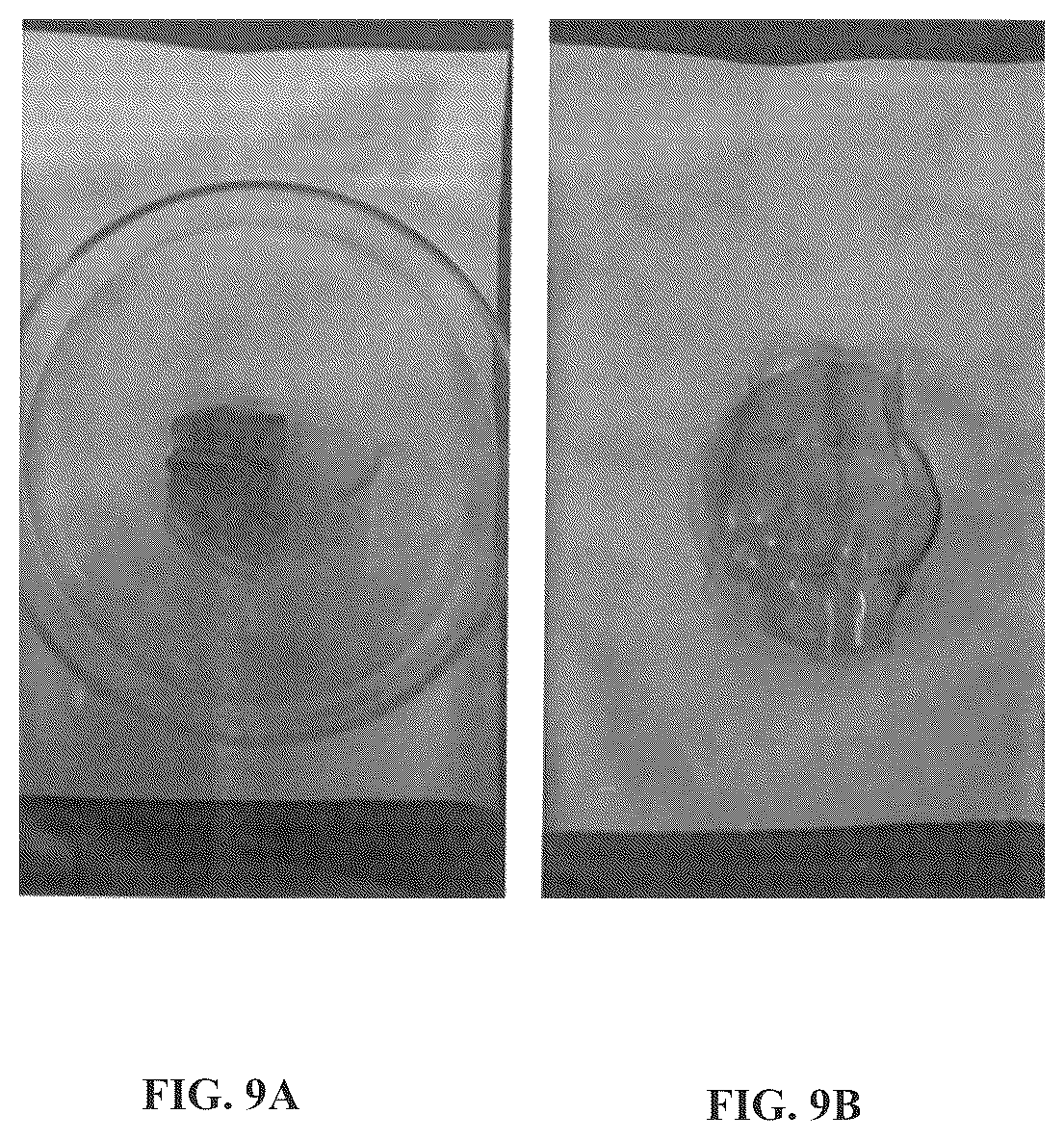 Patent US12508222 Figure 9 – Implantable and biodegradable drug delivery devices and methods of use thereof