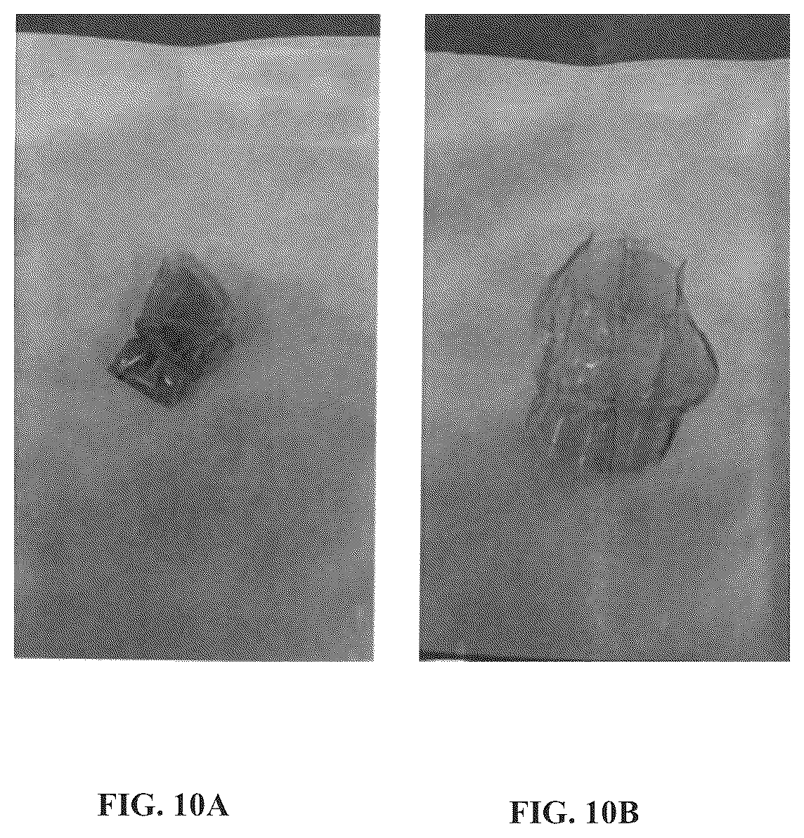 Patent US12508222 Figure 10 – Implantable and biodegradable drug delivery devices and methods of use thereof