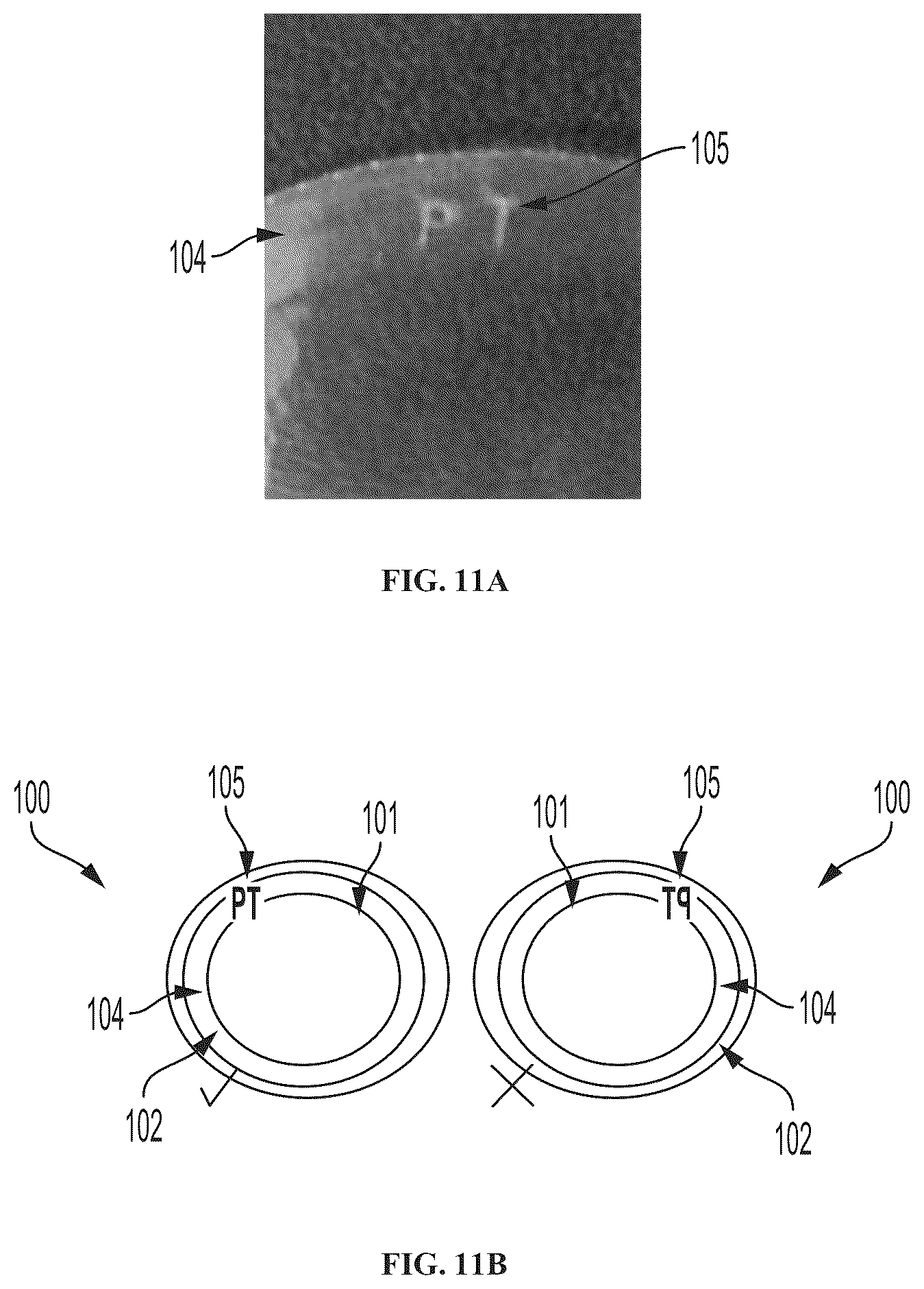 Patent US12508222 Figure 11 – Implantable and biodegradable drug delivery devices and methods of use thereof