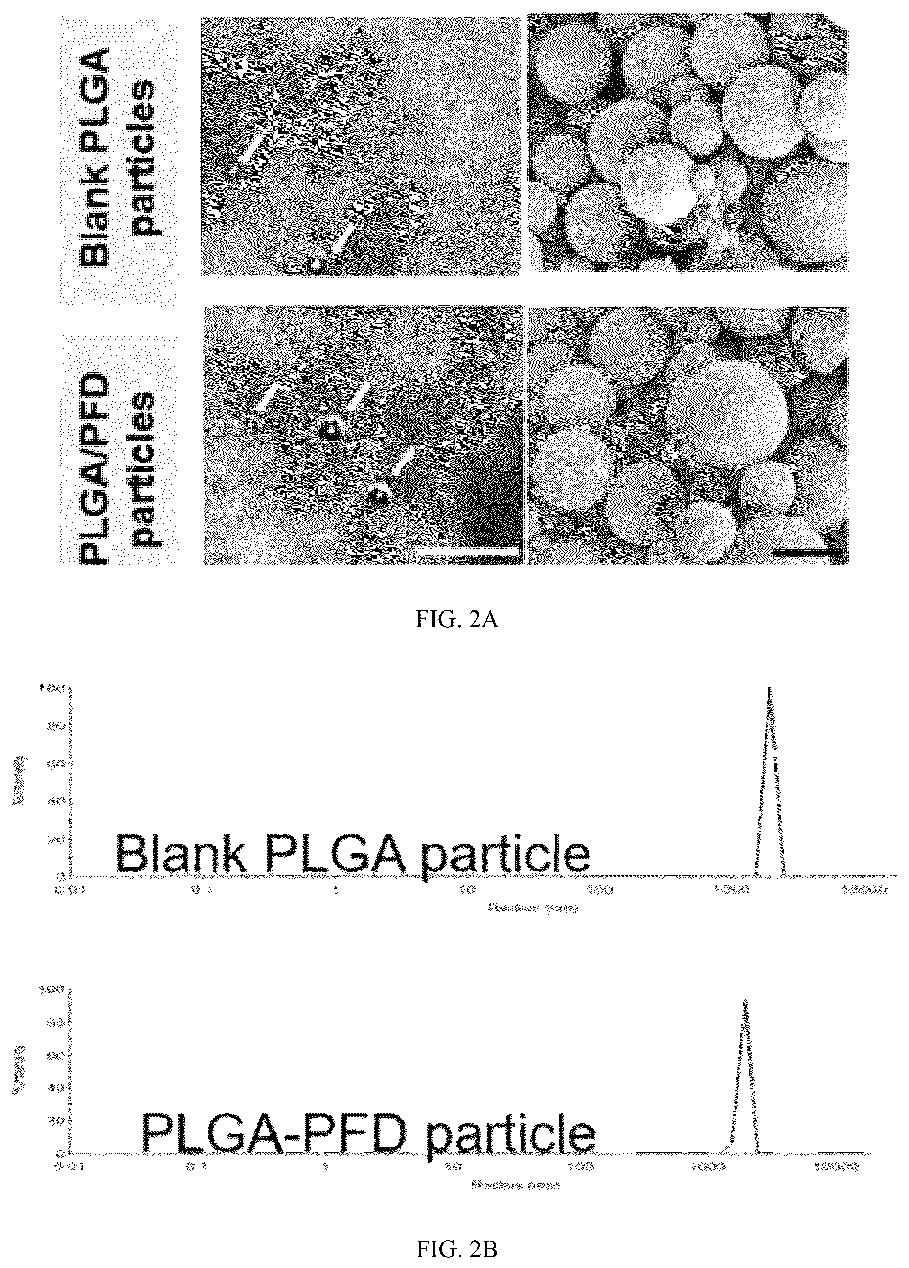 Patent US12508228 Figure 2 – PFD loaded microspheres and method for preparing injectable composite microsphere hydrogel solution from same