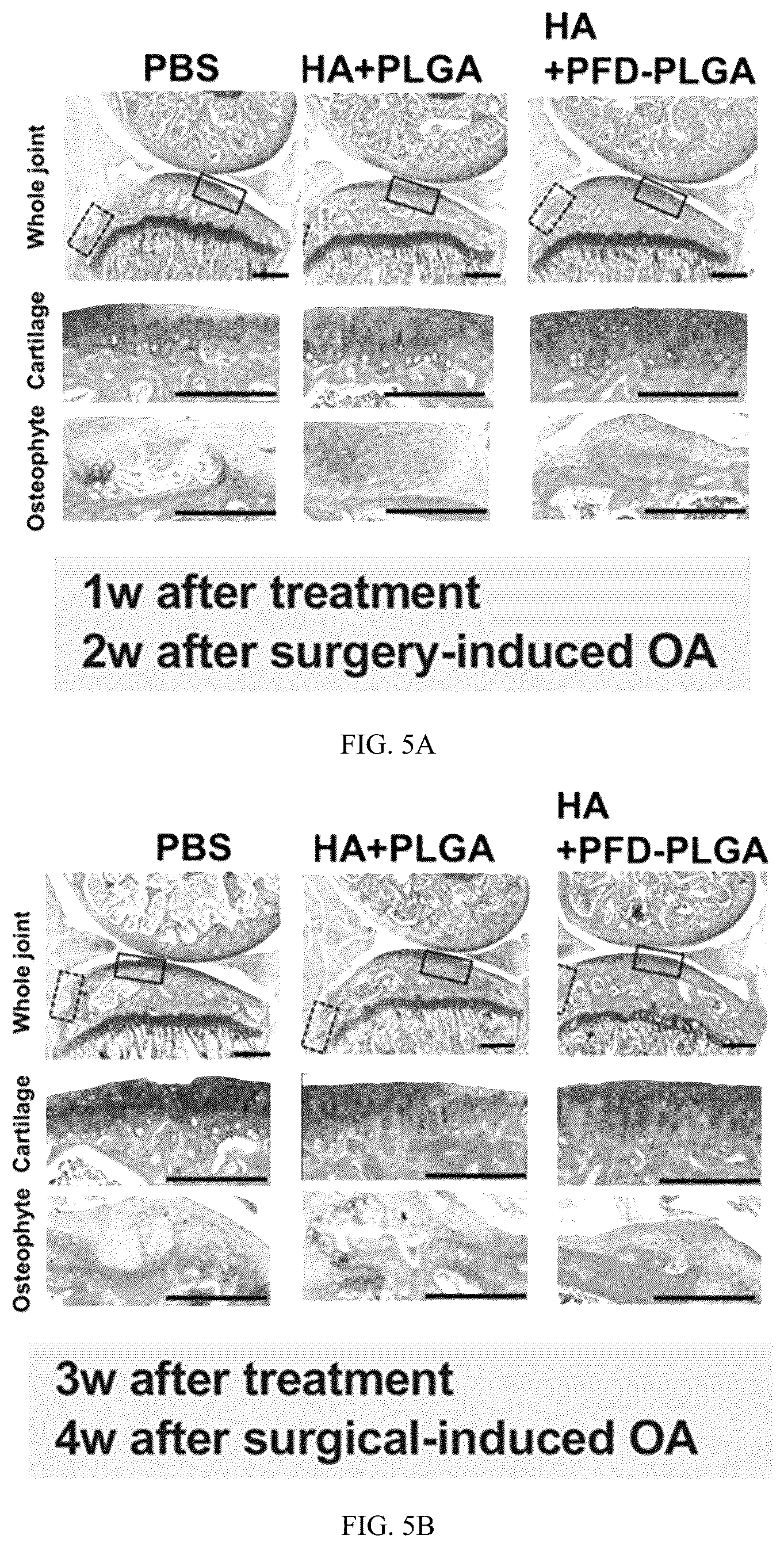 Patent US12508228 Figure 5 – PFD loaded microspheres and method for preparing injectable composite microsphere hydrogel solution from same
