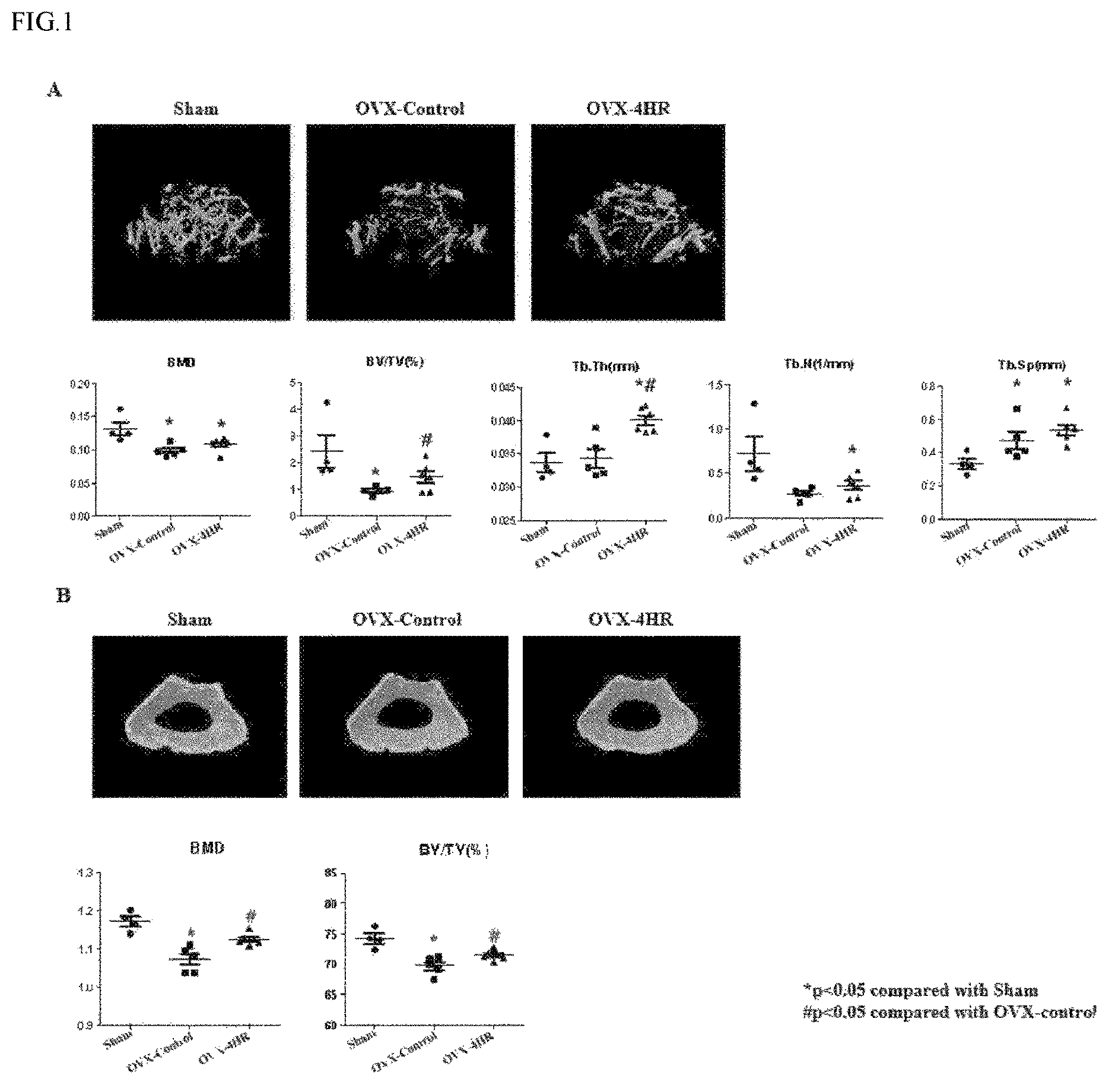 Patent US12508237 Figure 1 – Pharmaceutical composition comprising 4-hexylresorcinol as active ingredient for prevention or treatment of bone disease