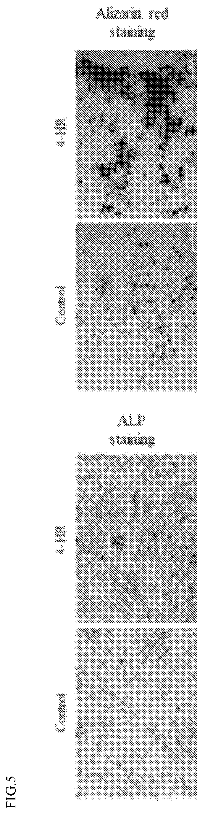 Patent US12508237 Figure 5 – Pharmaceutical composition comprising 4-hexylresorcinol as active ingredient for prevention or treatment of bone disease