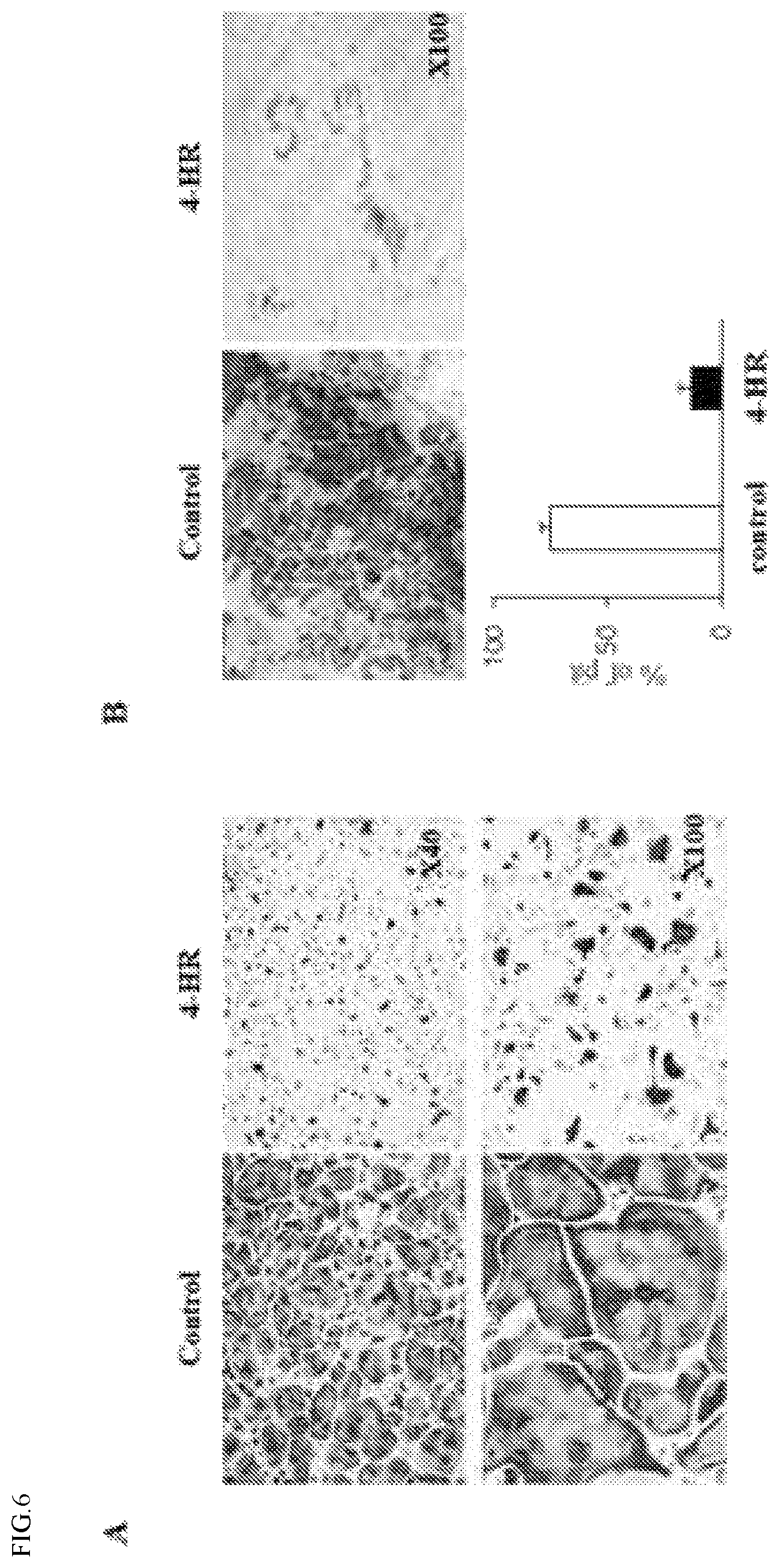 Patent US12508237 Figure 6 – Pharmaceutical composition comprising 4-hexylresorcinol as active ingredient for prevention or treatment of bone disease