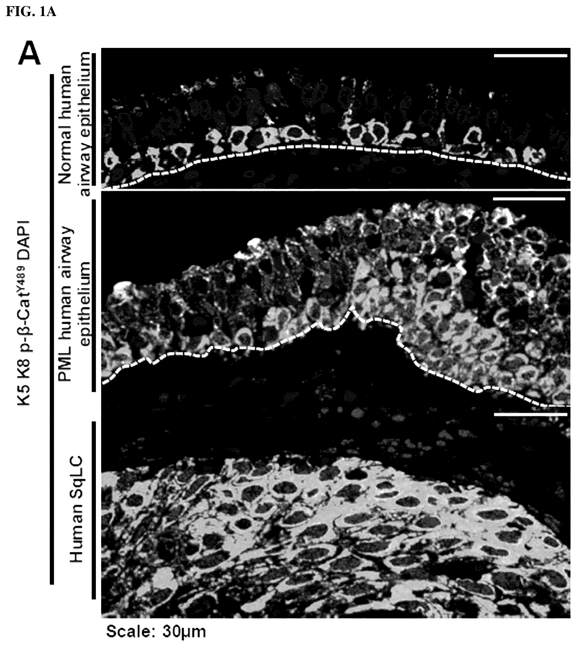 Patent US12508243 Figure 1 – Compositions and methods for treating cancer and improving epithelial homeostasis