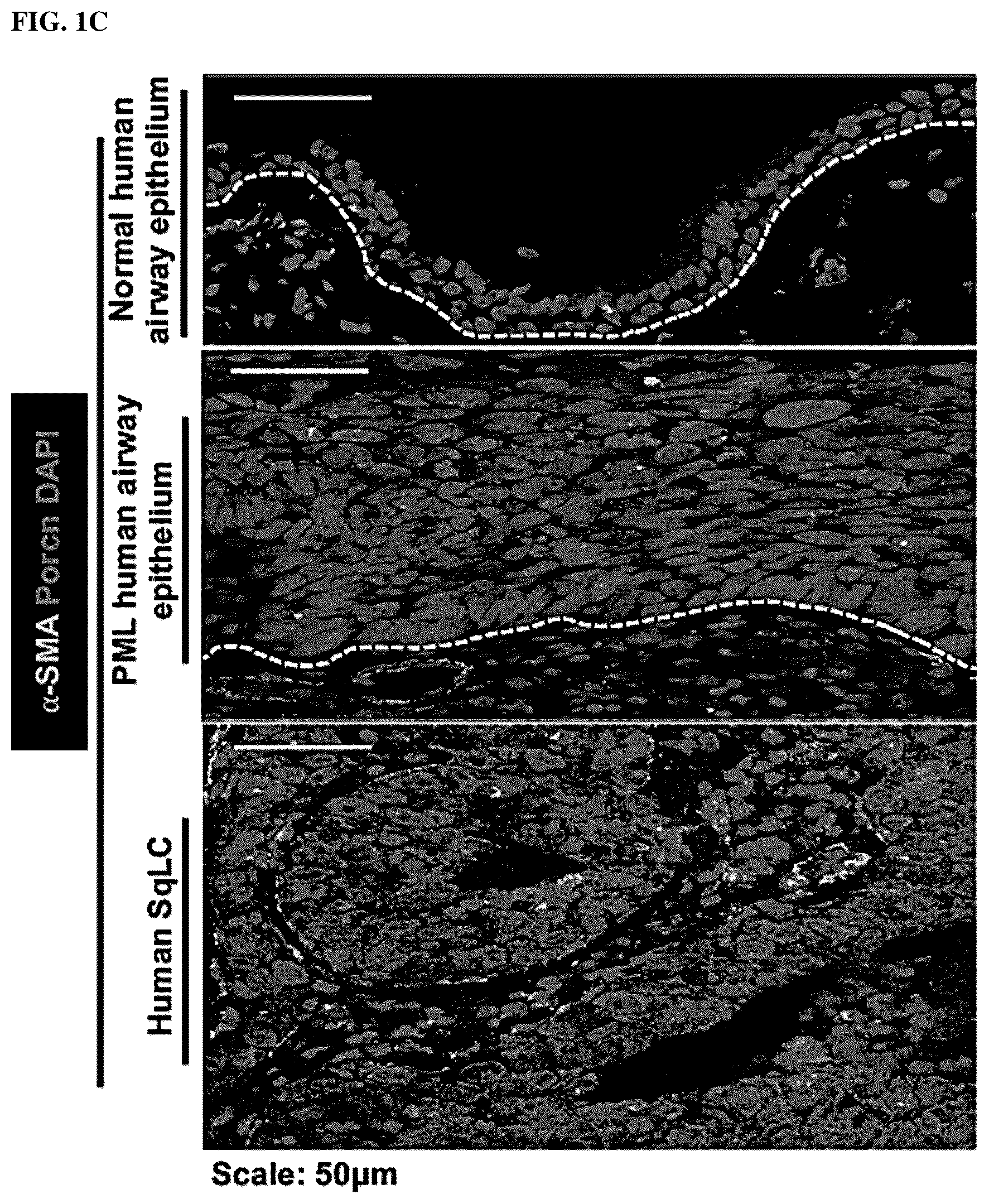 Patent US12508243 Figure 3 – Compositions and methods for treating cancer and improving epithelial homeostasis