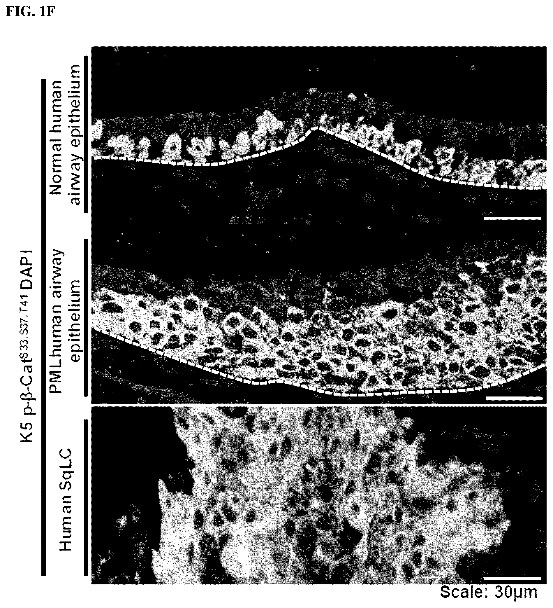 Patent US12508243 Figure 5 – Compositions and methods for treating cancer and improving epithelial homeostasis