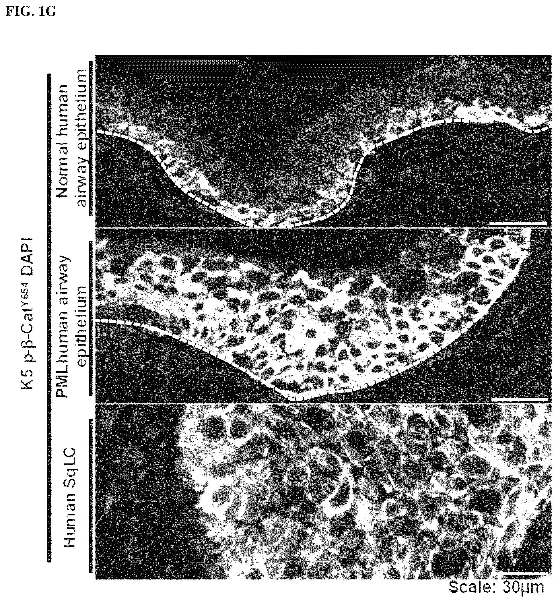Patent US12508243 Figure 6 – Compositions and methods for treating cancer and improving epithelial homeostasis