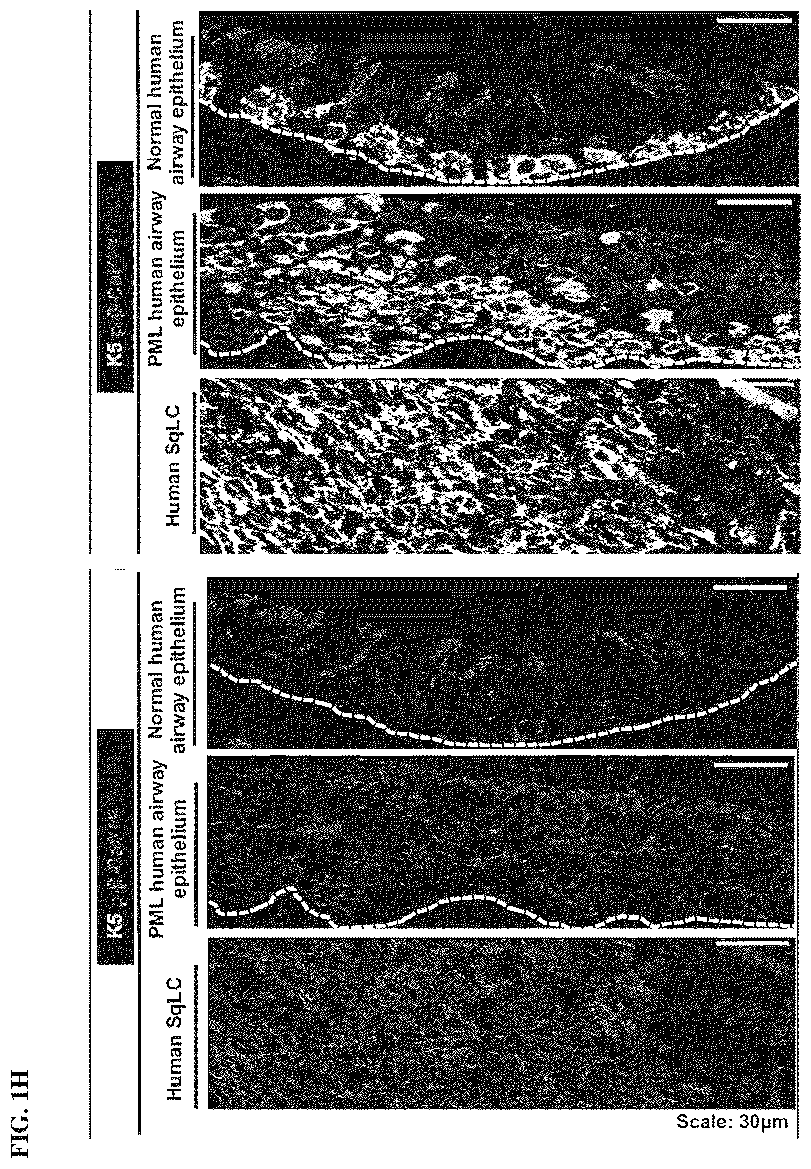 Patent US12508243 Figure 7 – Compositions and methods for treating cancer and improving epithelial homeostasis