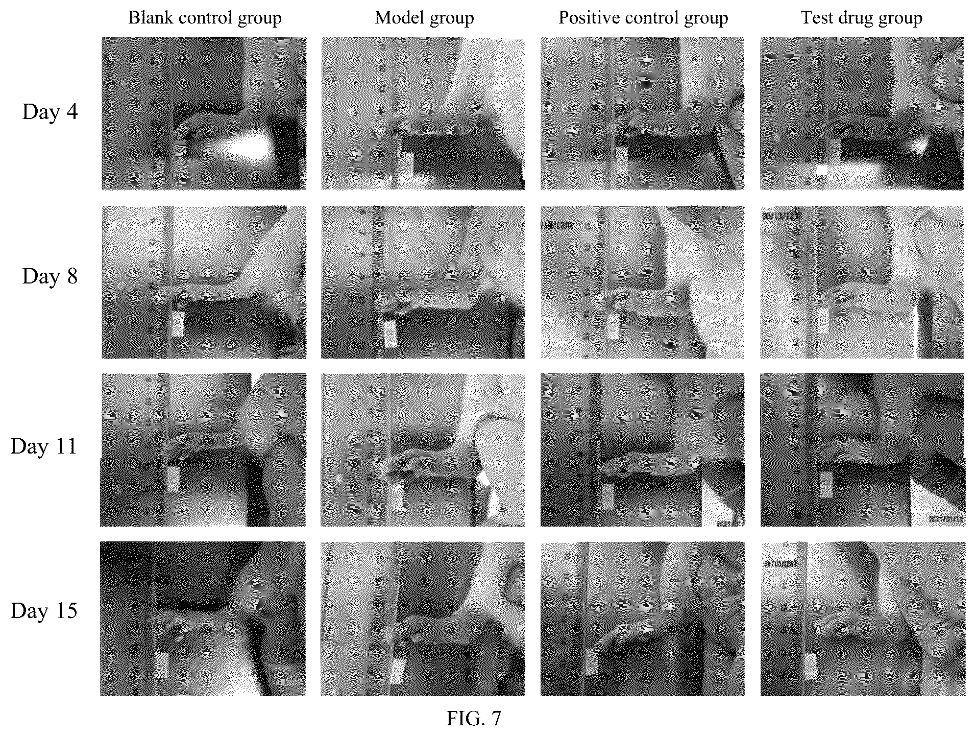 Patent US12508258 Figure 4 – Quinoline derivative for treating rheumatoid arthritis