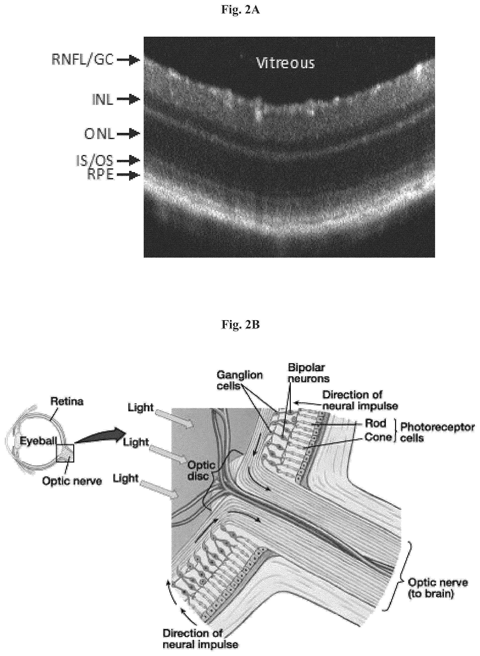 Patent US12508282 Figure 3 – Mitochondrial transplantation and use thereof in ocular diseases