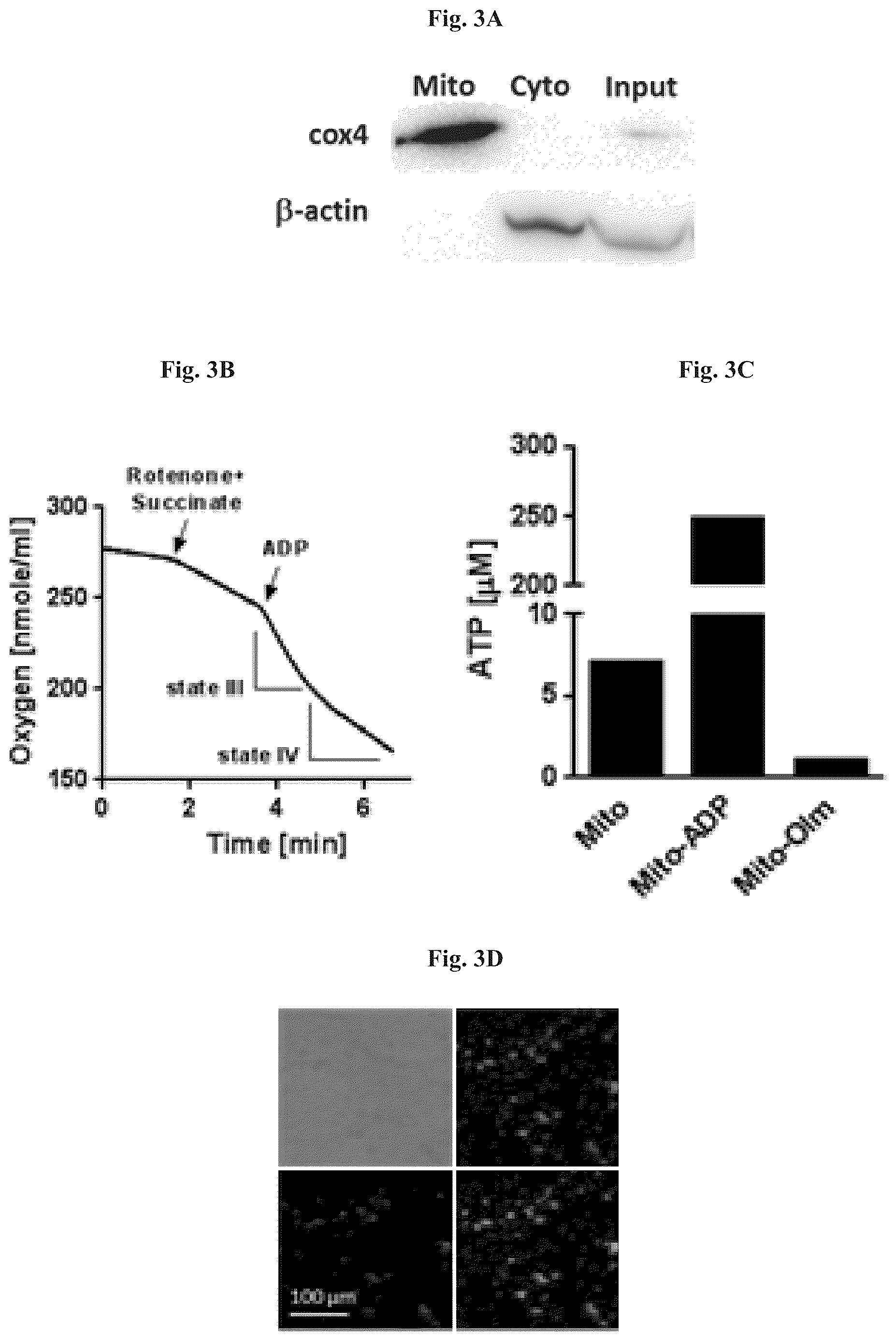 Patent US12508282 Figure 4 – Mitochondrial transplantation and use thereof in ocular diseases