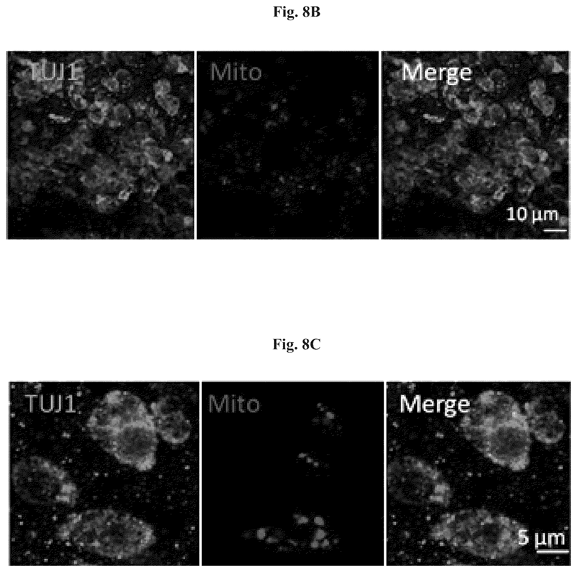 Patent US12508282 Figure 10 – Mitochondrial transplantation and use thereof in ocular diseases