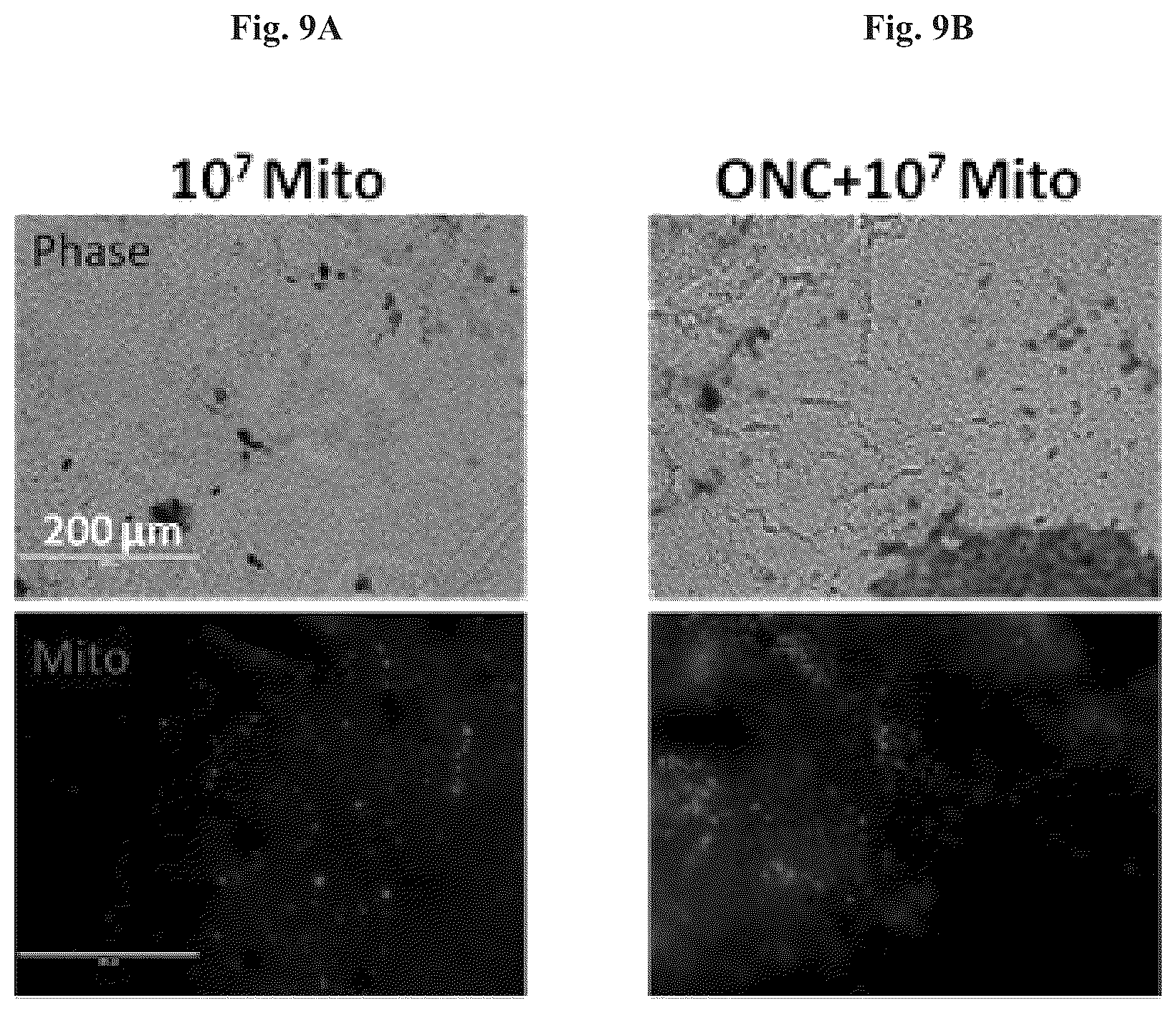 Patent US12508282 Figure 11 – Mitochondrial transplantation and use thereof in ocular diseases