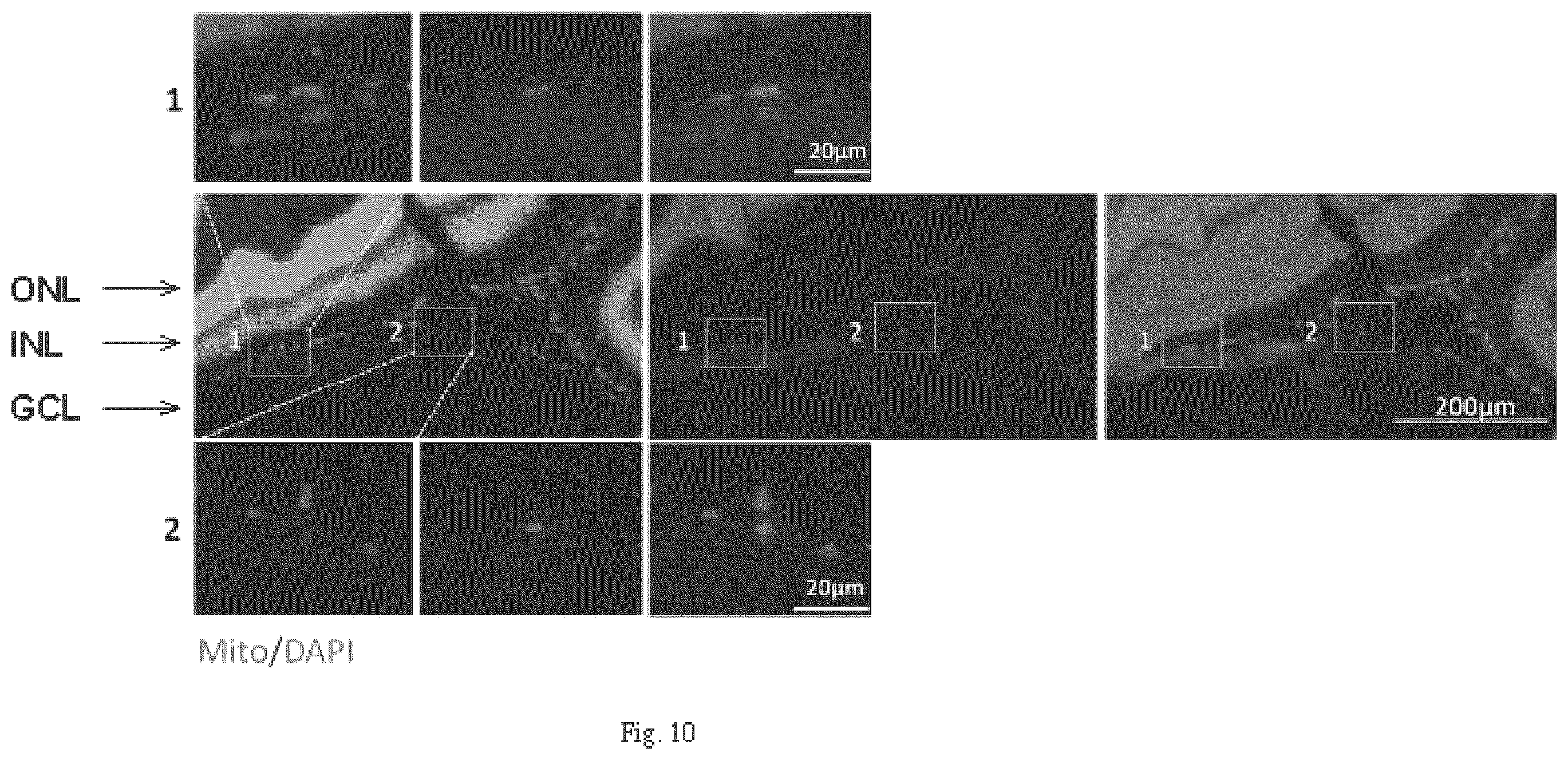 Patent US12508282 Figure 12 – Mitochondrial transplantation and use thereof in ocular diseases