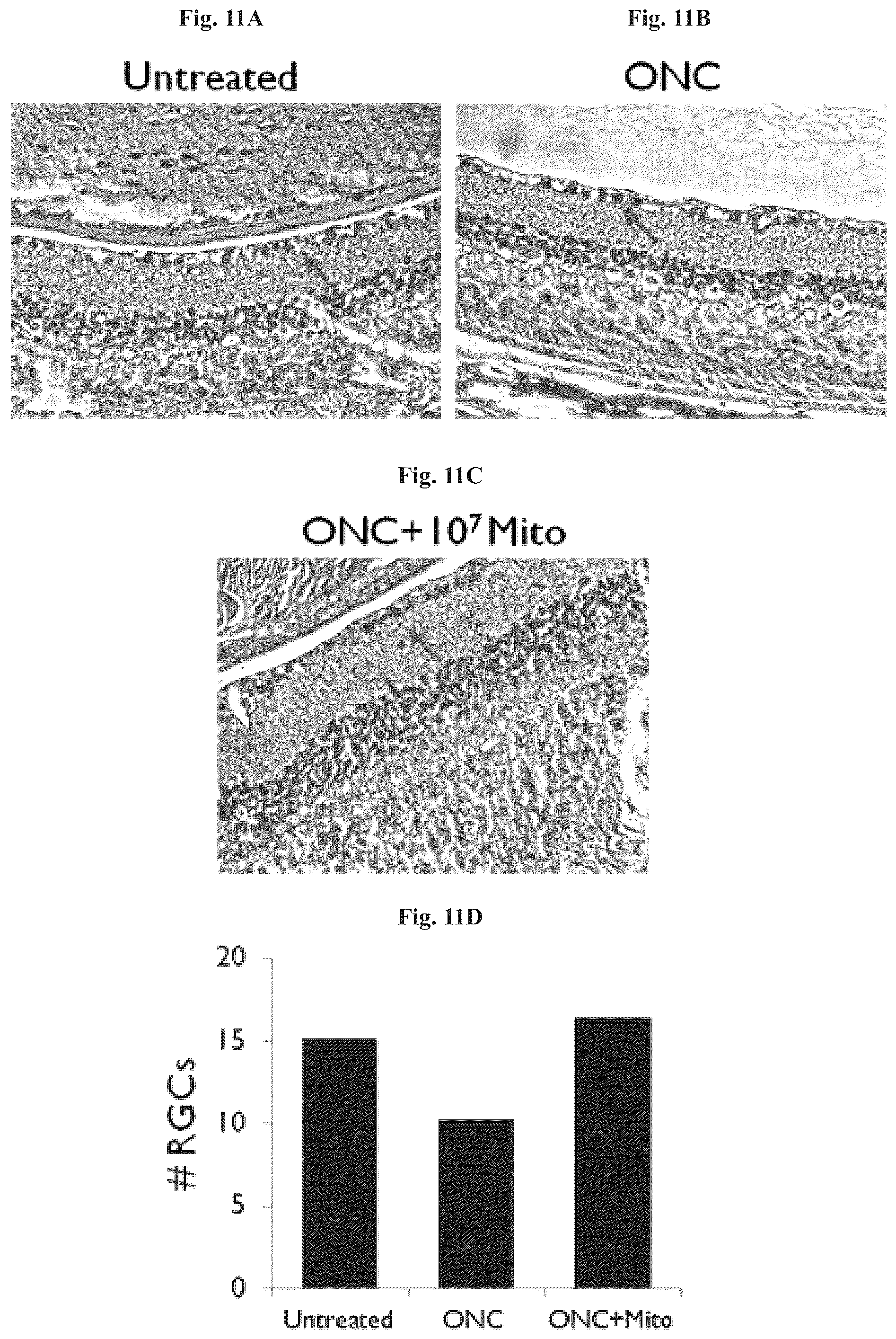 Patent US12508282 Figure 13 – Mitochondrial transplantation and use thereof in ocular diseases