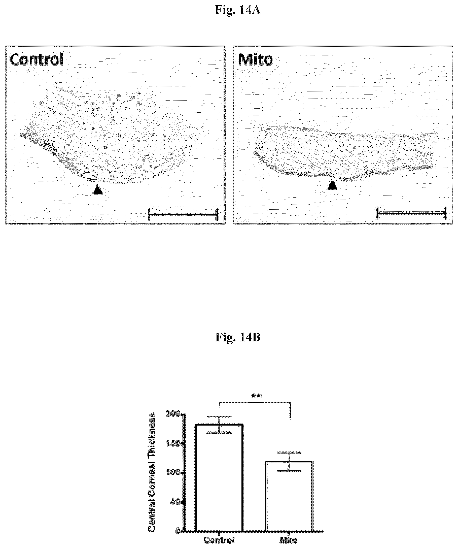 Patent US12508282 Figure 16 – Mitochondrial transplantation and use thereof in ocular diseases