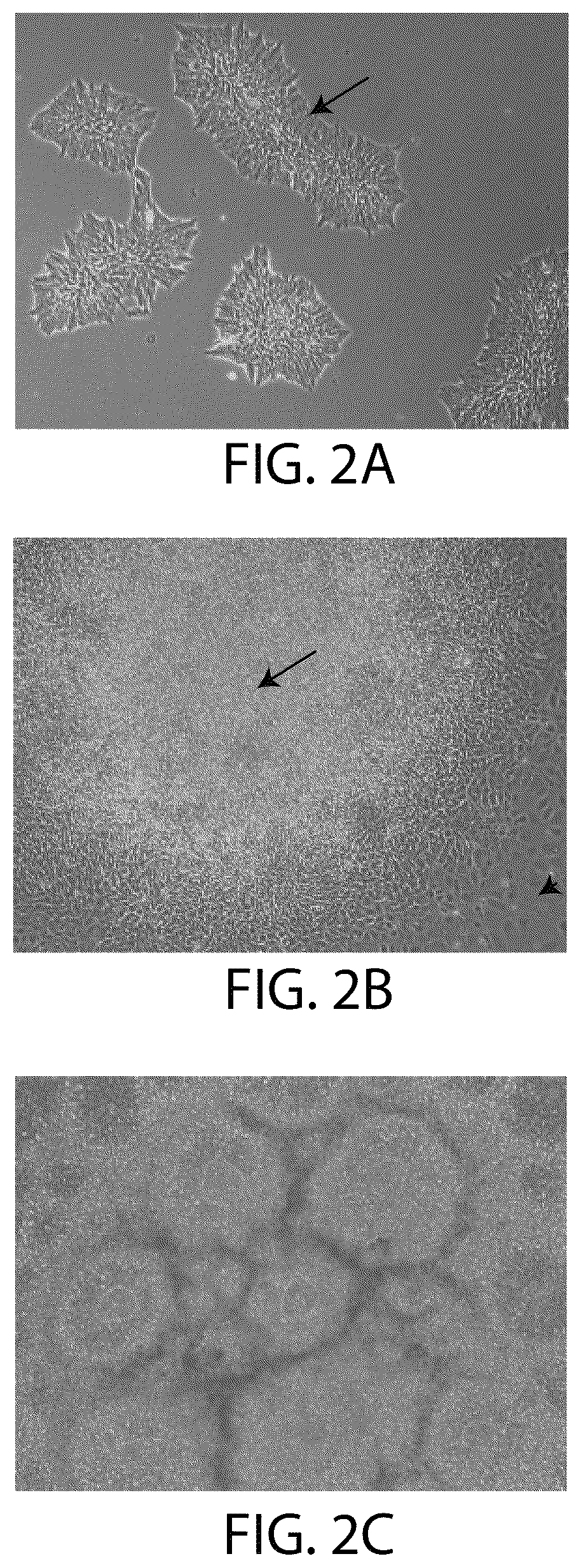Patent US12508284 Figure 2 – Photoreceptors and photoreceptor progenitors produced from pluripotent stem cells