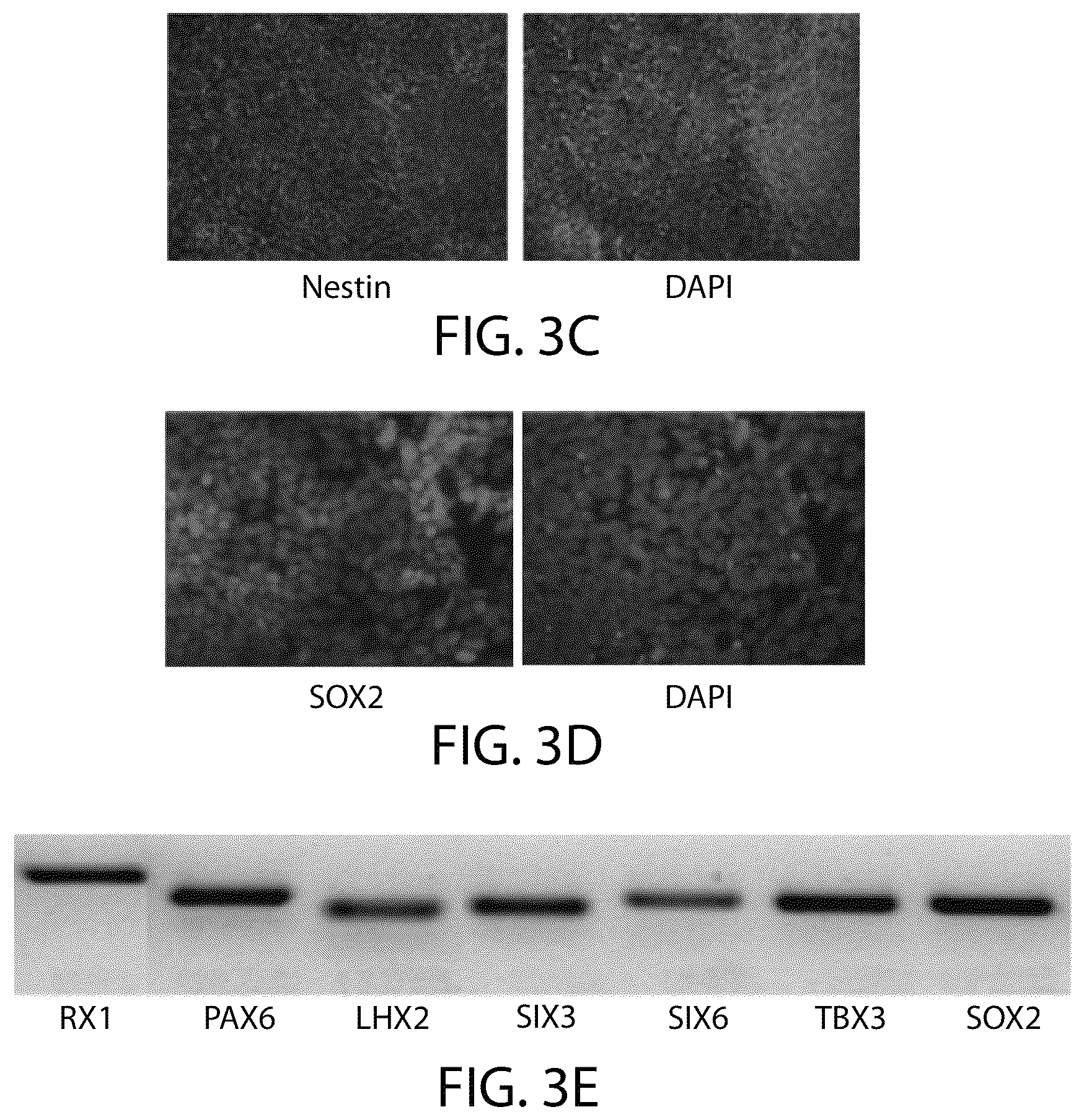 Patent US12508284 Figure 4 – Photoreceptors and photoreceptor progenitors produced from pluripotent stem cells