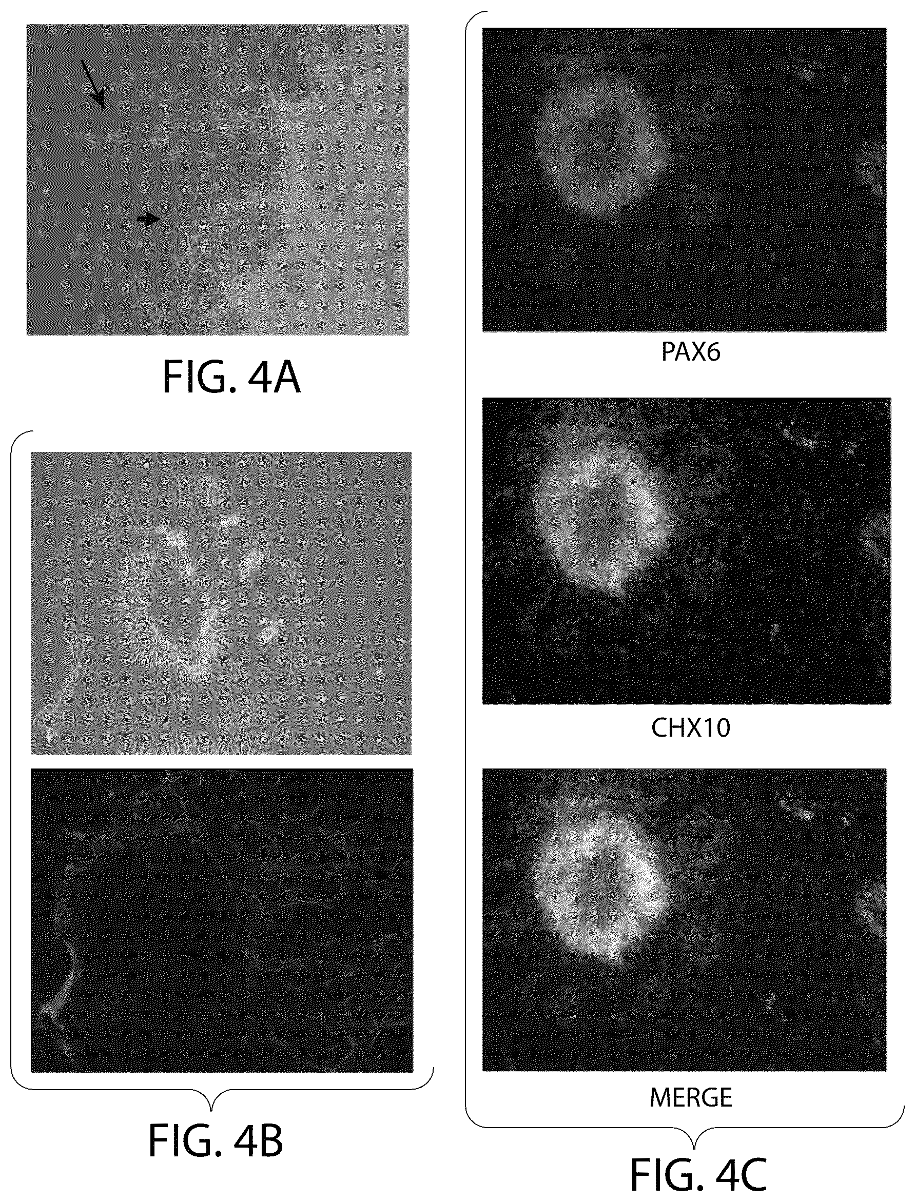 Patent US12508284 Figure 5 – Photoreceptors and photoreceptor progenitors produced from pluripotent stem cells
