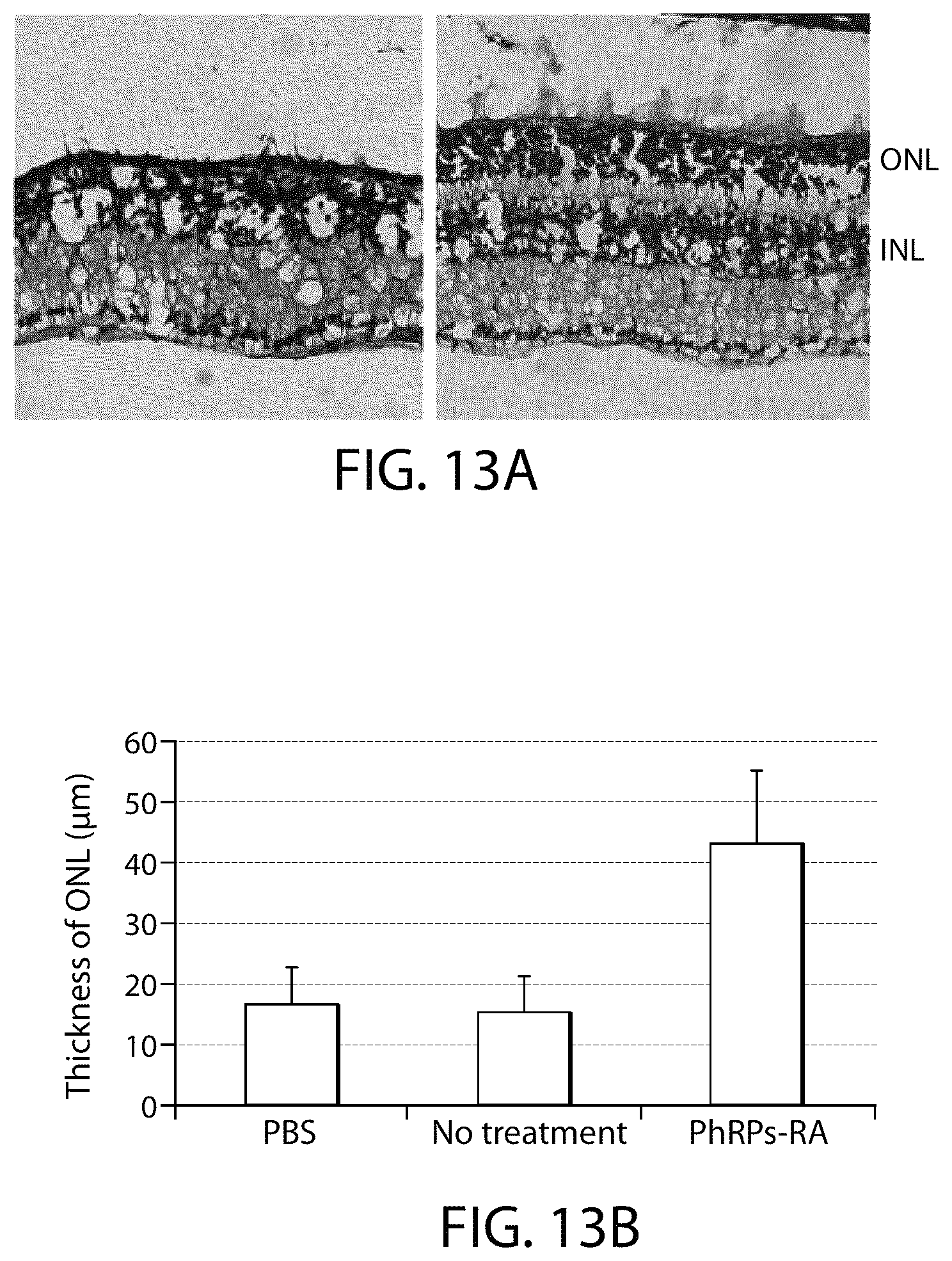 Patent US12508284 Figure 15 – Photoreceptors and photoreceptor progenitors produced from pluripotent stem cells