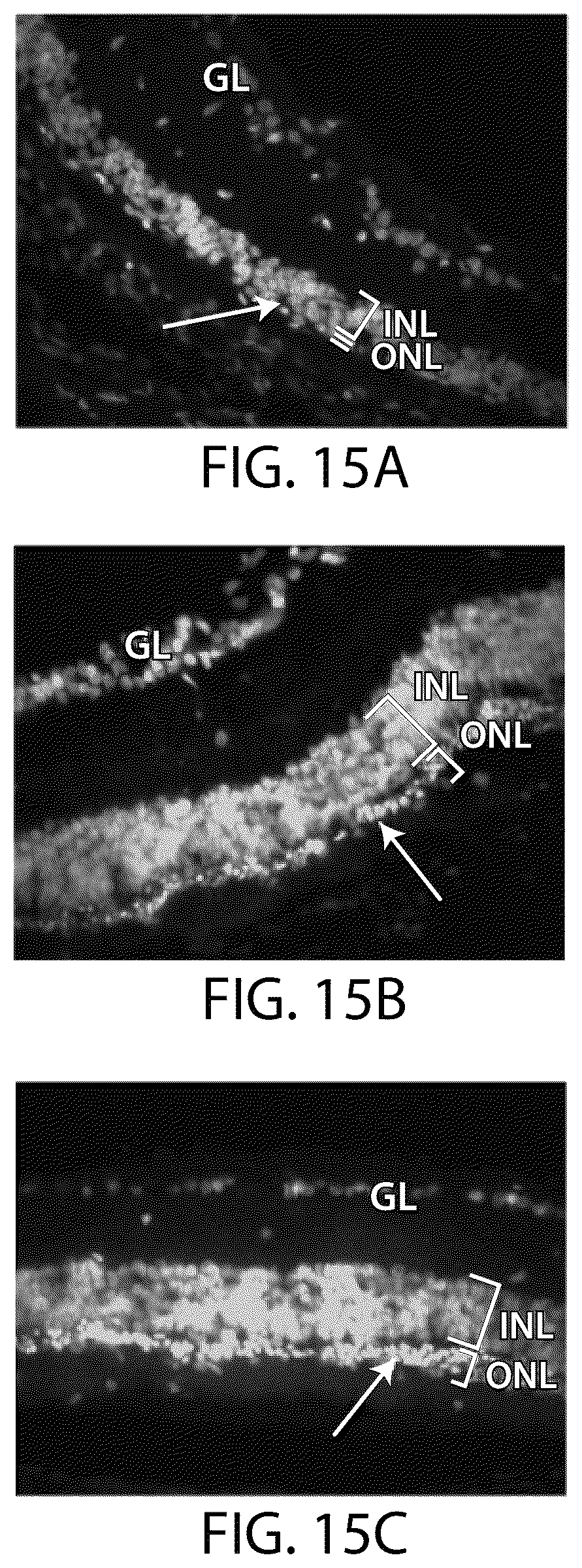 Patent US12508284 Figure 17 – Photoreceptors and photoreceptor progenitors produced from pluripotent stem cells