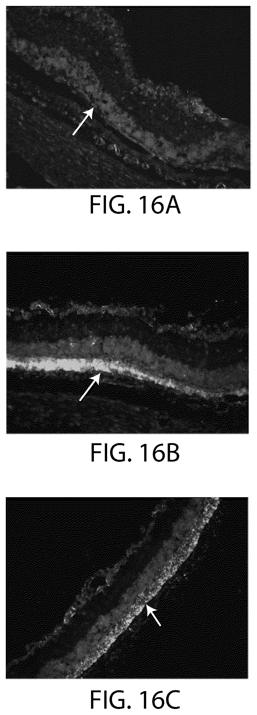 Patent US12508284 Figure 18 – Photoreceptors and photoreceptor progenitors produced from pluripotent stem cells