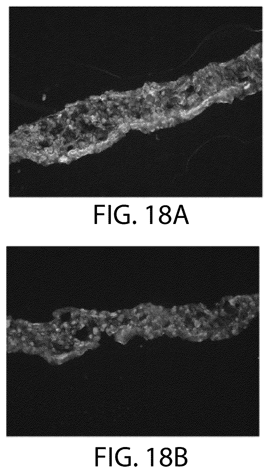 Patent US12508284 Figure 20 – Photoreceptors and photoreceptor progenitors produced from pluripotent stem cells