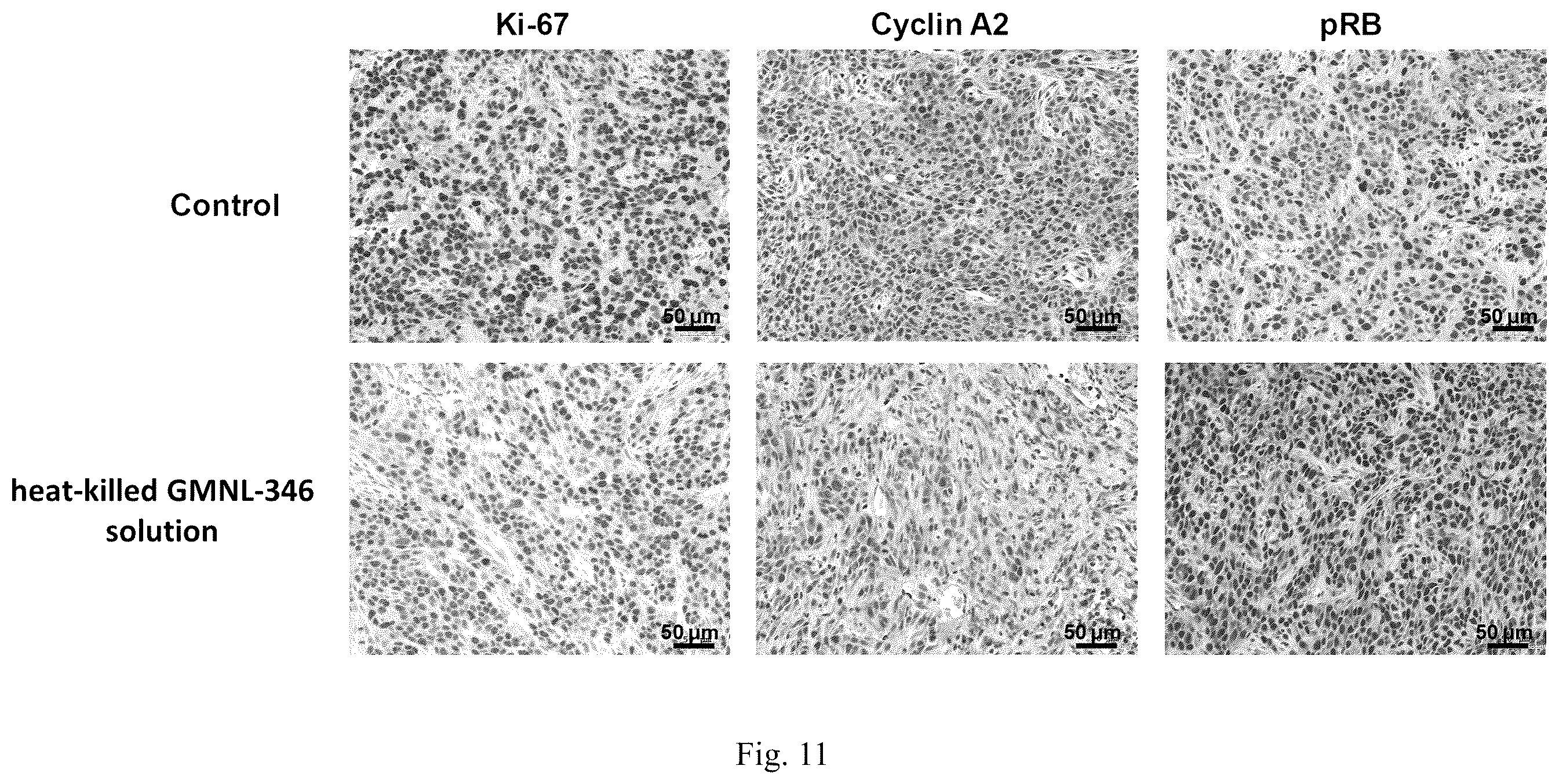 Patent US12508290 Figure 7 – Use of Lactobacillus paracasei GMNL-346 for anti-oral cancer treatment and thereof