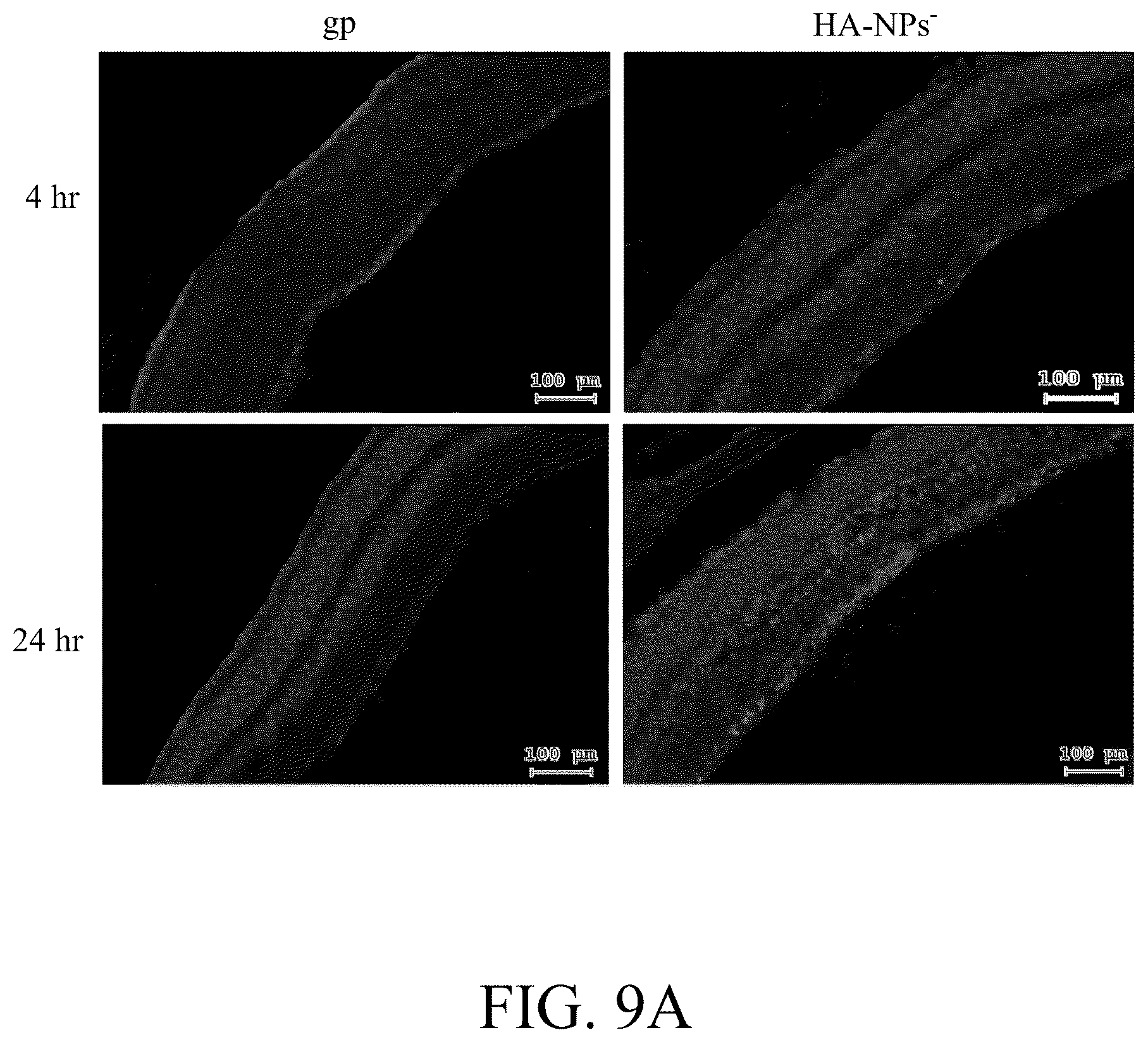 Patent US12508294 Figure 13 – Self-assembled nanoparticle and use thereof for anti-angiogenesis