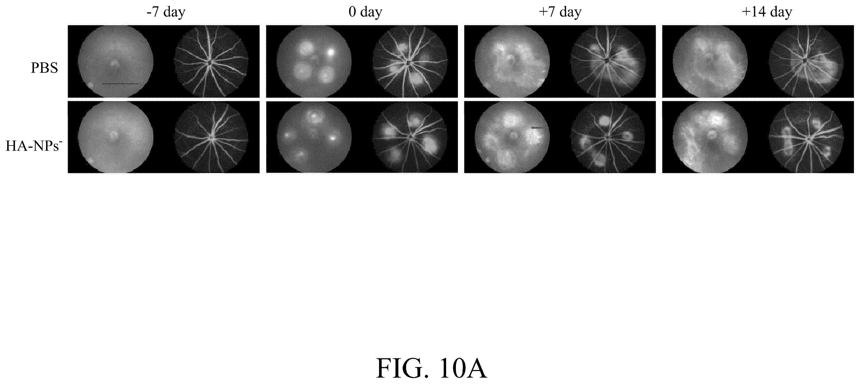 Patent US12508294 Figure 15 – Self-assembled nanoparticle and use thereof for anti-angiogenesis