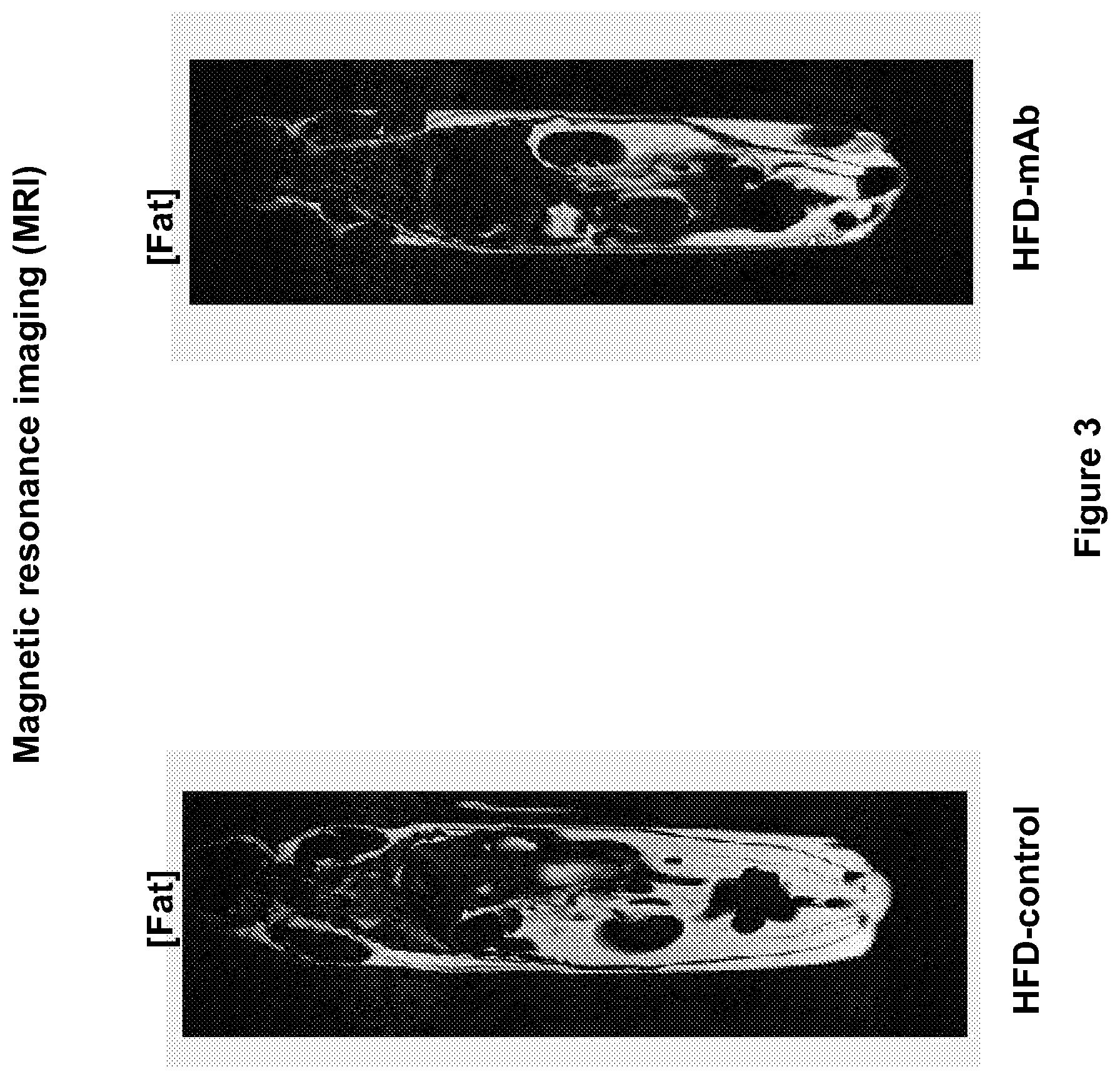 Patent US12508299 Figure 4 – Compositions and methods for treating obesity and hyperphagia