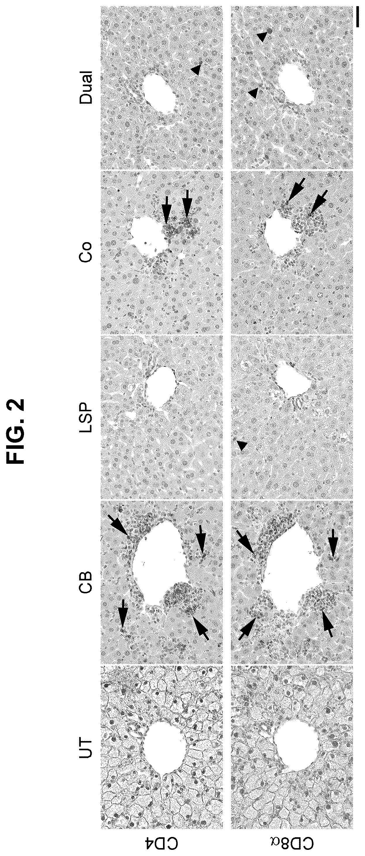 Patent US12508305 Figure 3 – Compositions and methods for treating and/or preventing glycogen storage disease type III