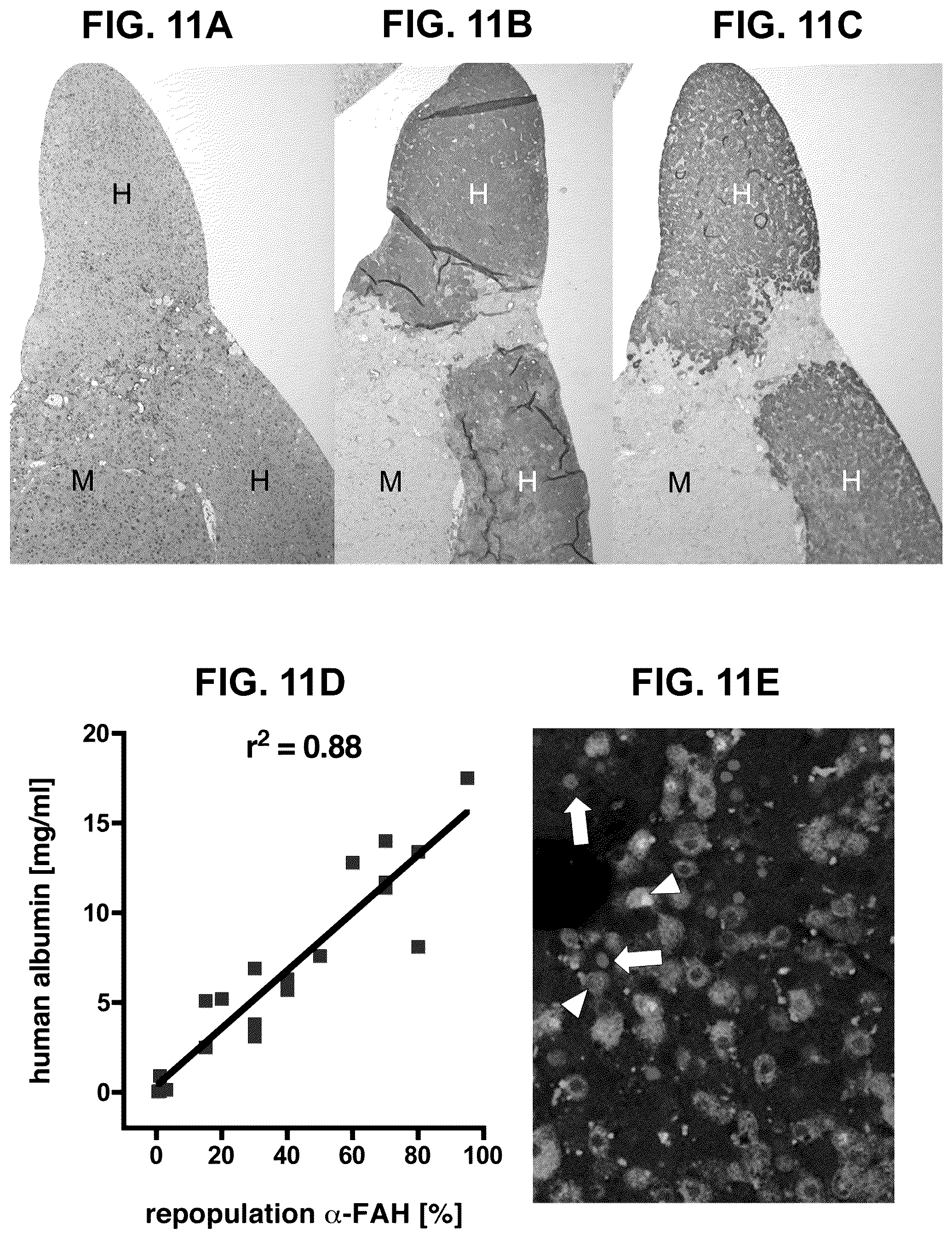 Patent US12508305 Figure 13 – Compositions and methods for treating and/or preventing glycogen storage disease type III