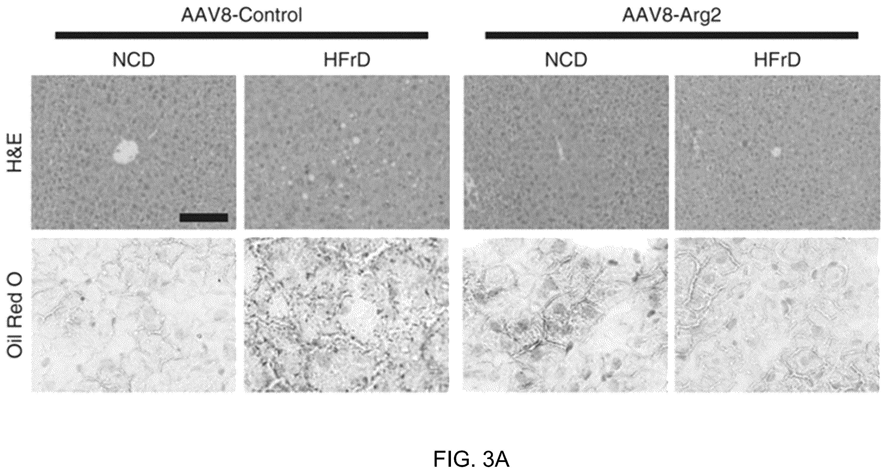 Patent US12508306 Figure 11 – Compositions and methods of use thereof for treatment of metabolic diseases and related disorders