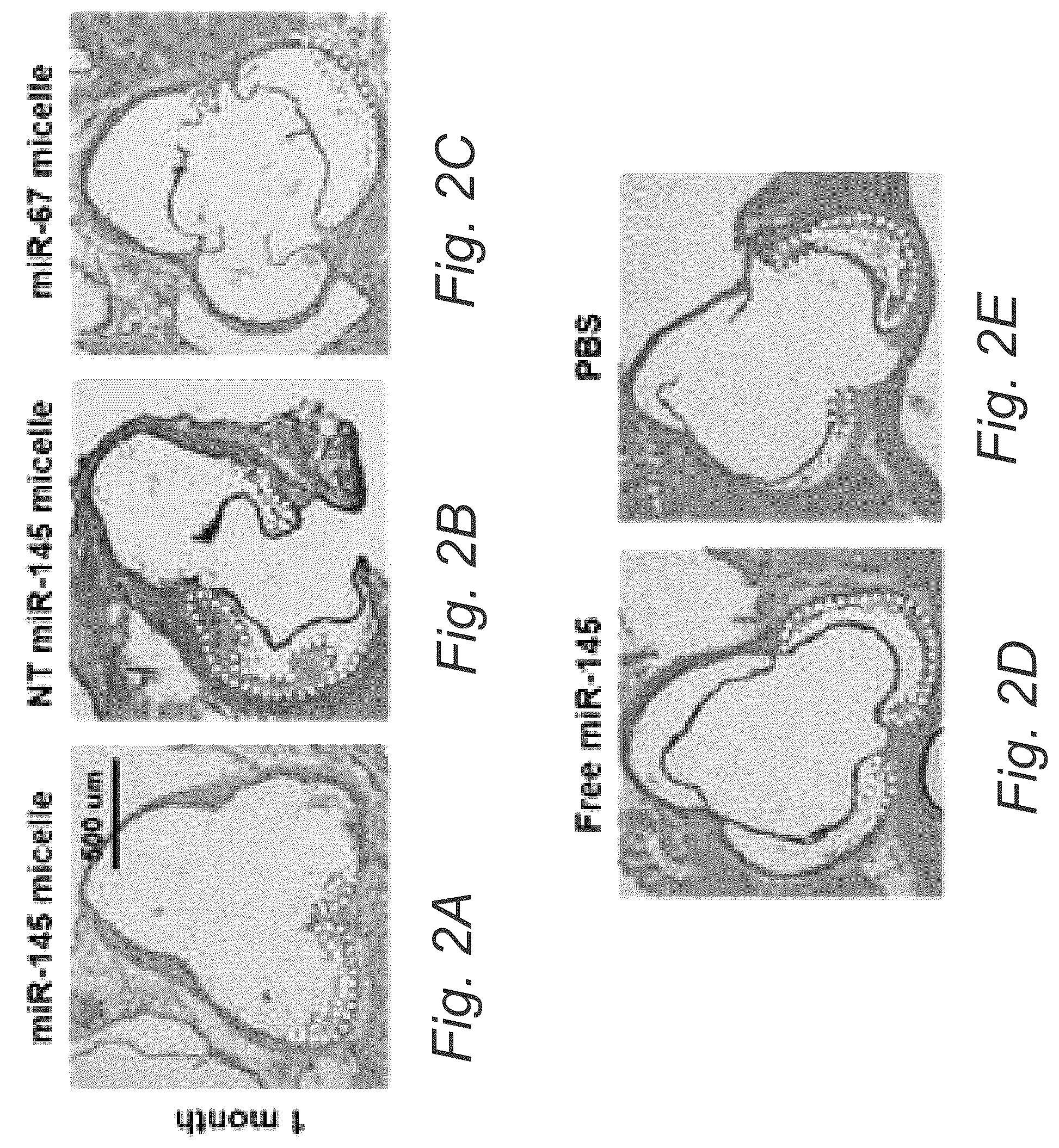 Patent US12508322 Figure 2 – MIR-145 micelles for mitigating atherosclerosis