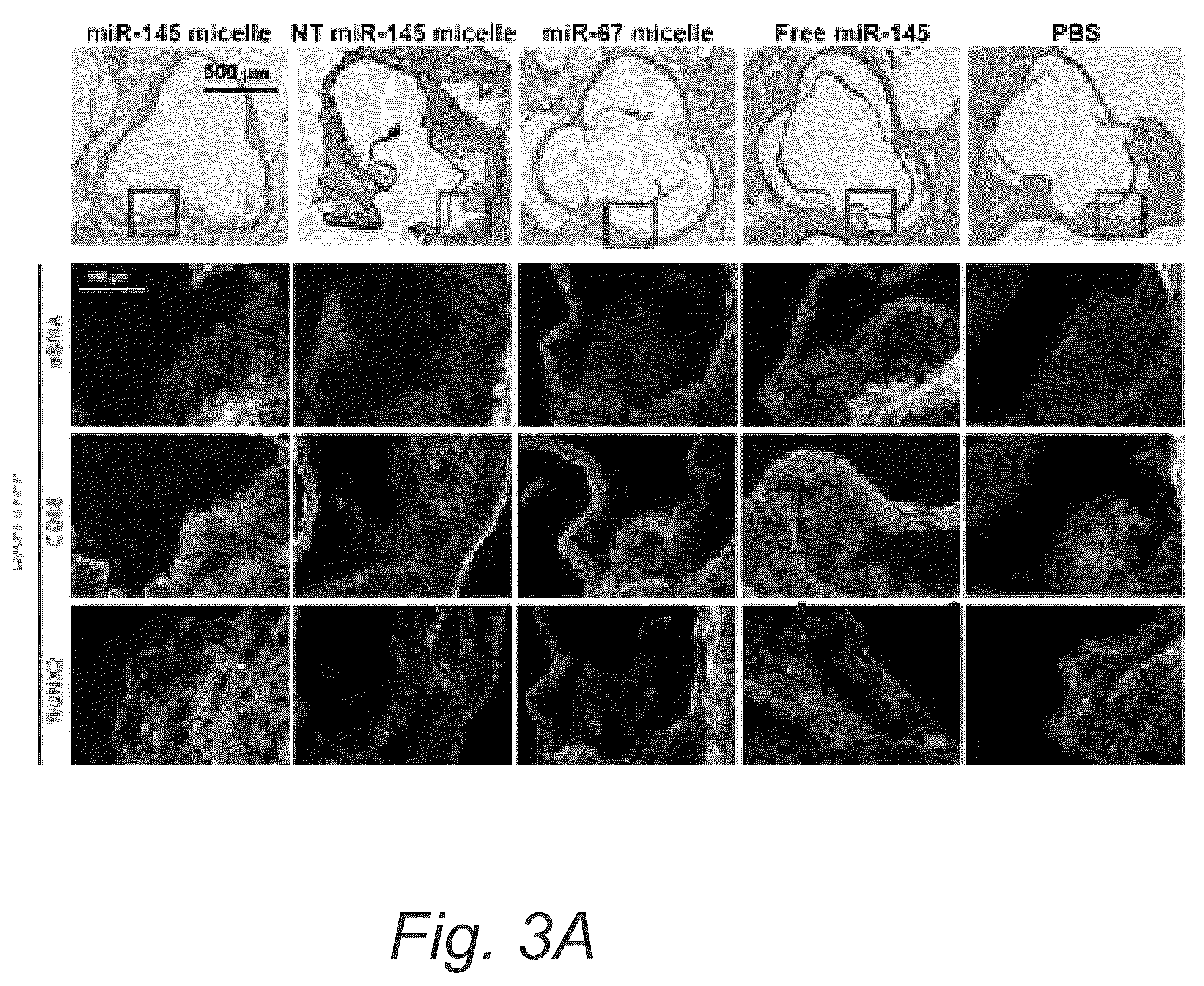 Patent US12508322 Figure 4 – MIR-145 micelles for mitigating atherosclerosis