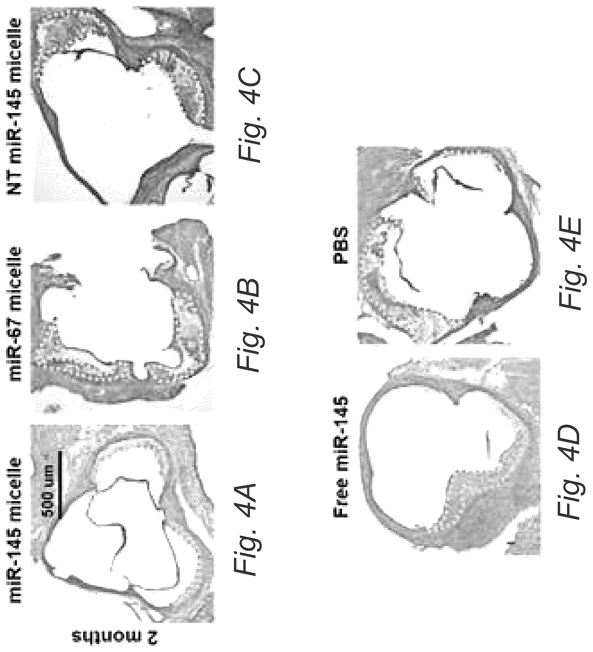 Patent US12508322 Figure 7 – MIR-145 micelles for mitigating atherosclerosis