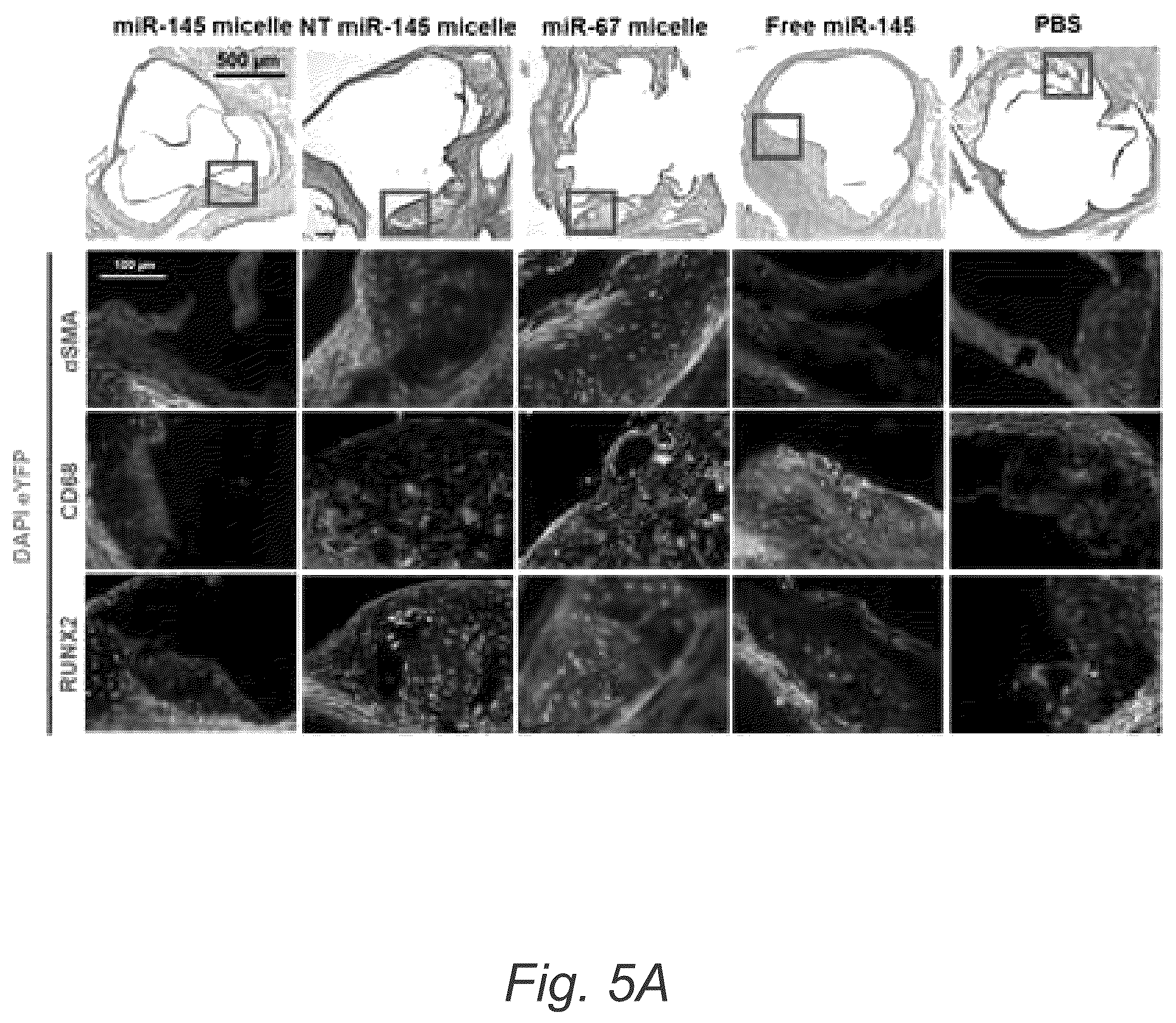 Patent US12508322 Figure 9 – MIR-145 micelles for mitigating atherosclerosis